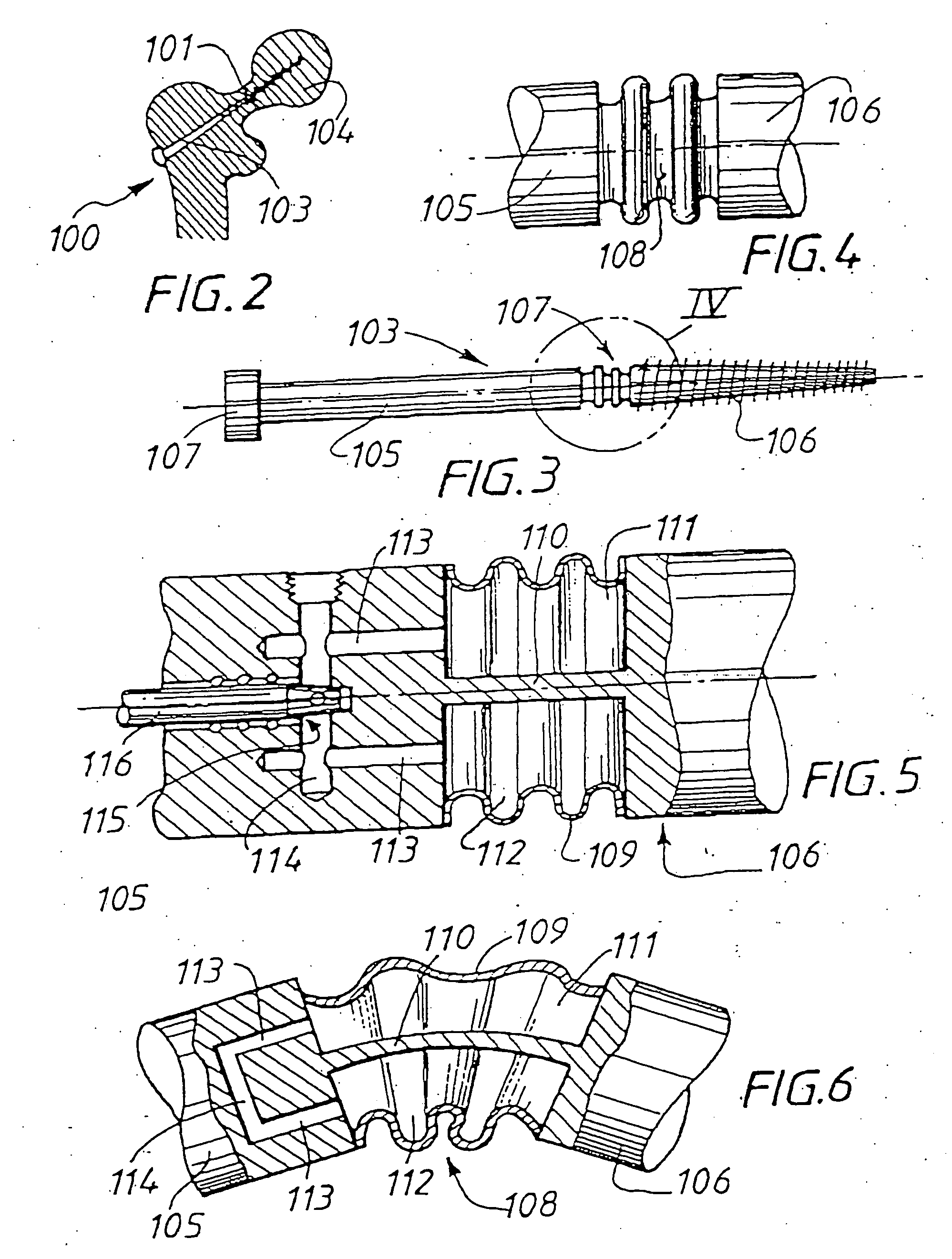 Skeletal implant