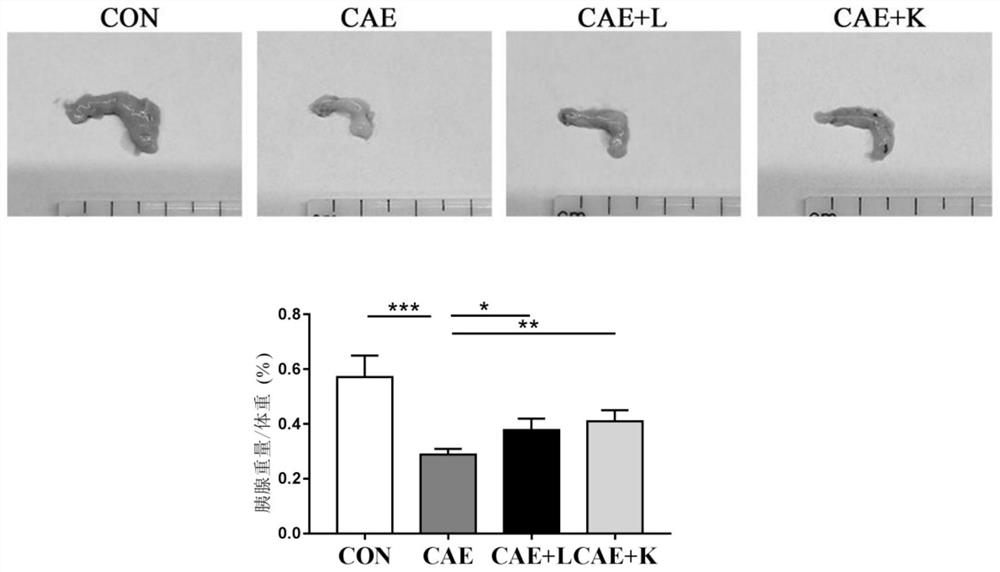 Application of Akkermansia muciniphila in the aspect of treating chronic pancreatitis