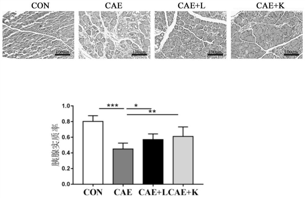 Application of Akkermansia muciniphila in the aspect of treating chronic pancreatitis