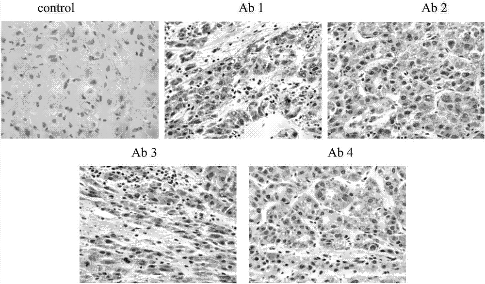 High-specificity and high-sensitivity monoclonal antibody for detecting human alpha-fetoprotein as well as reagent kit and application