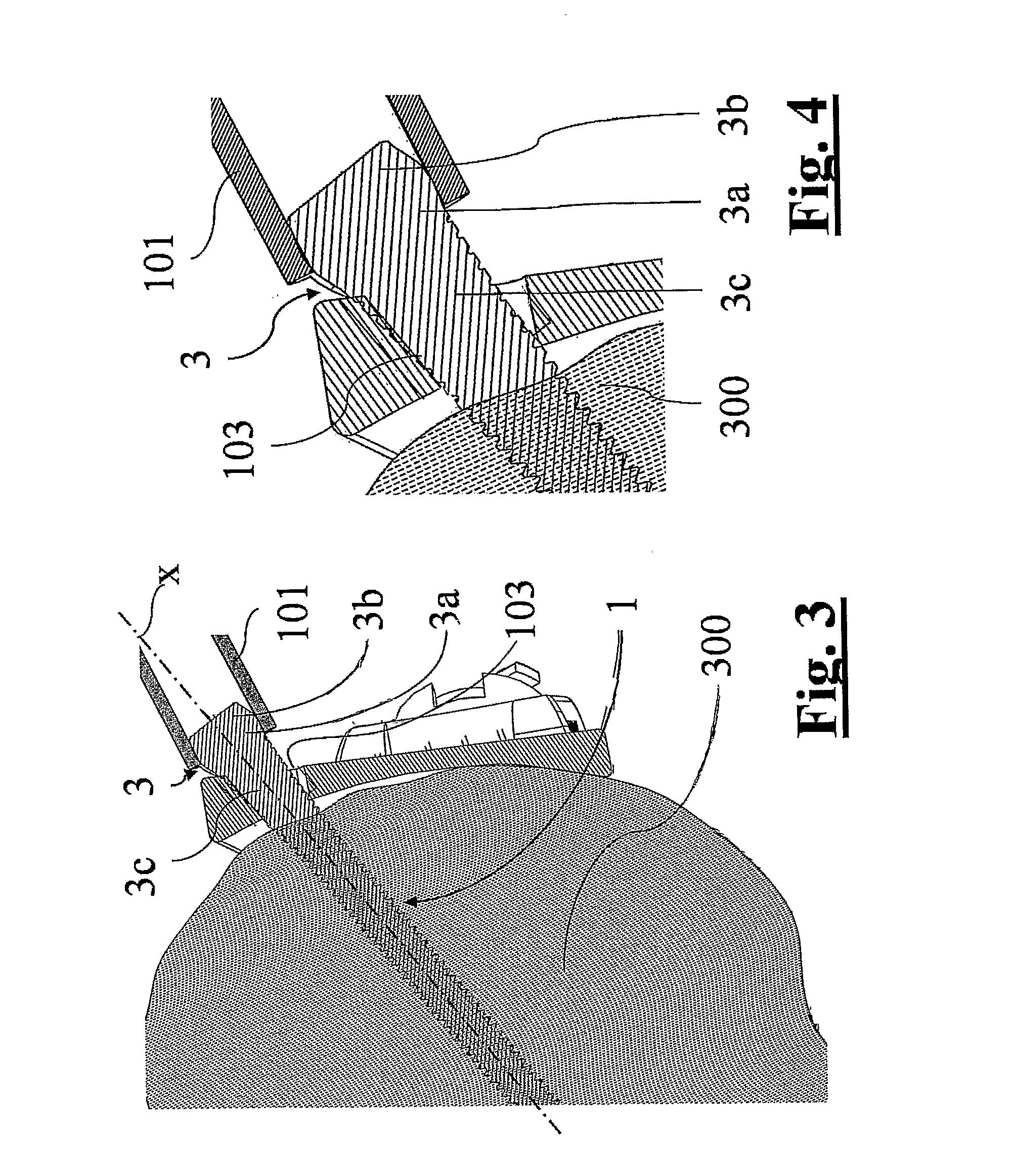 Endosseous screws and orthopaedic device to assist the rigid osteosynthesis of fractures