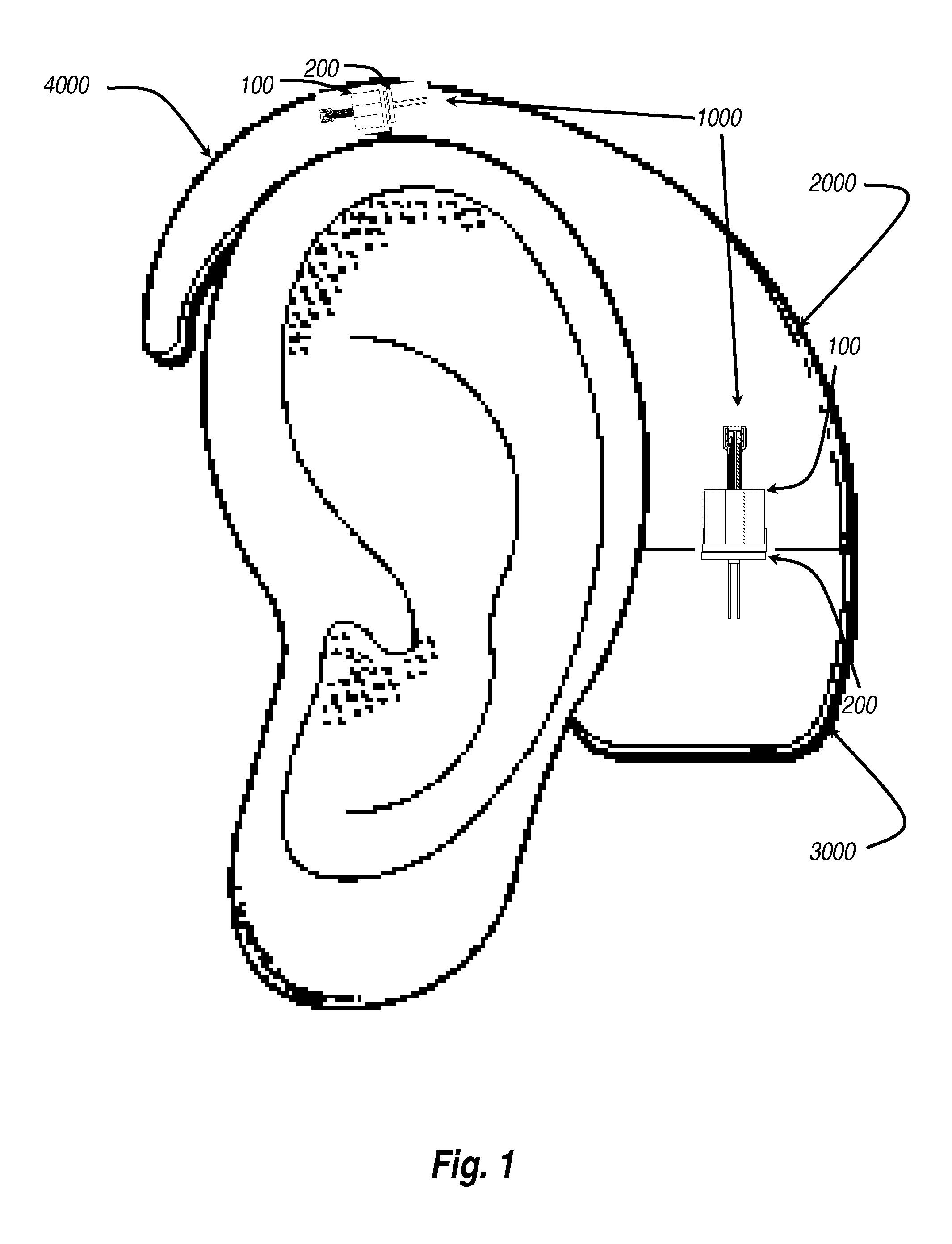 Multi-contact connector system