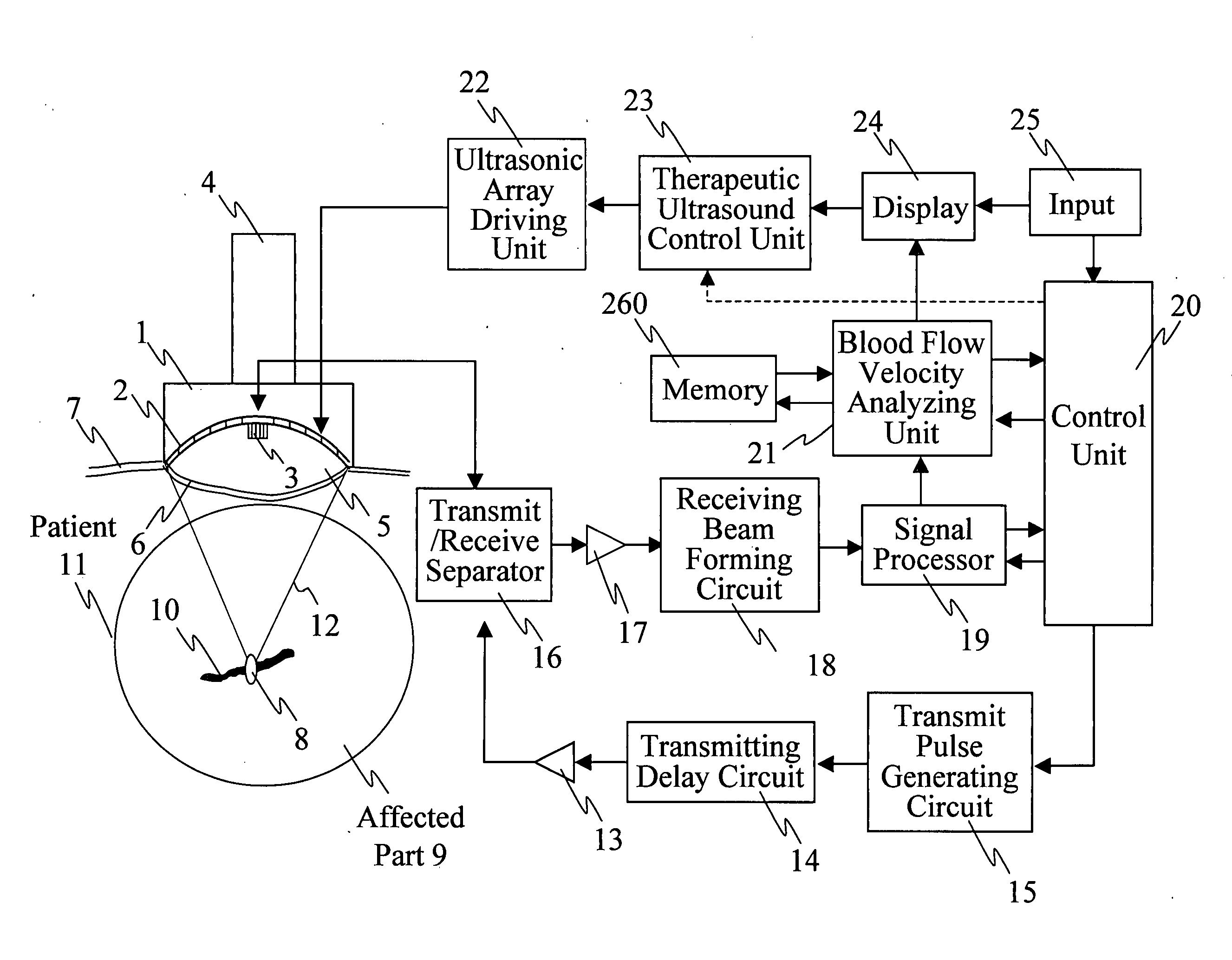 Ultrasonic treatment equipment