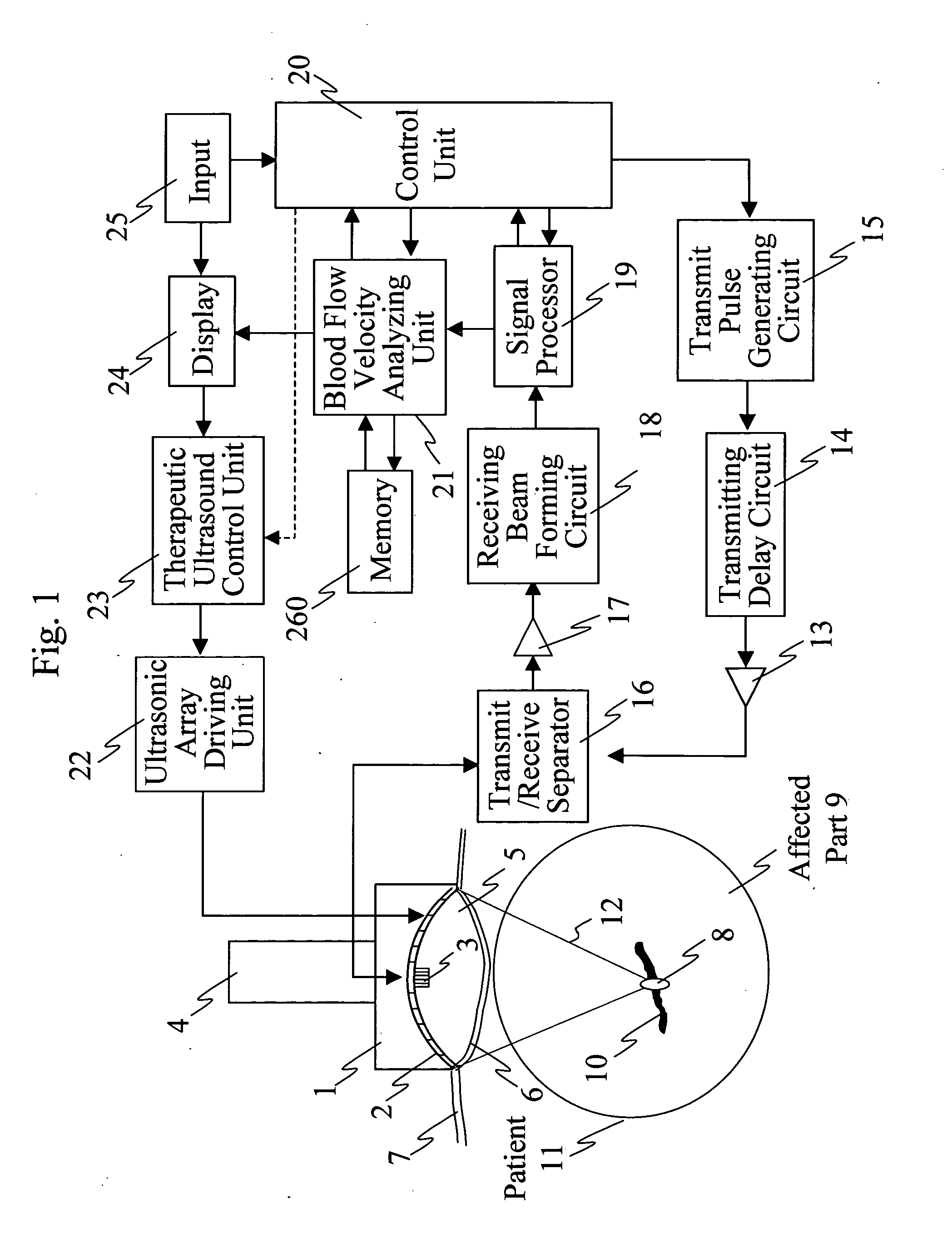 Ultrasonic treatment equipment