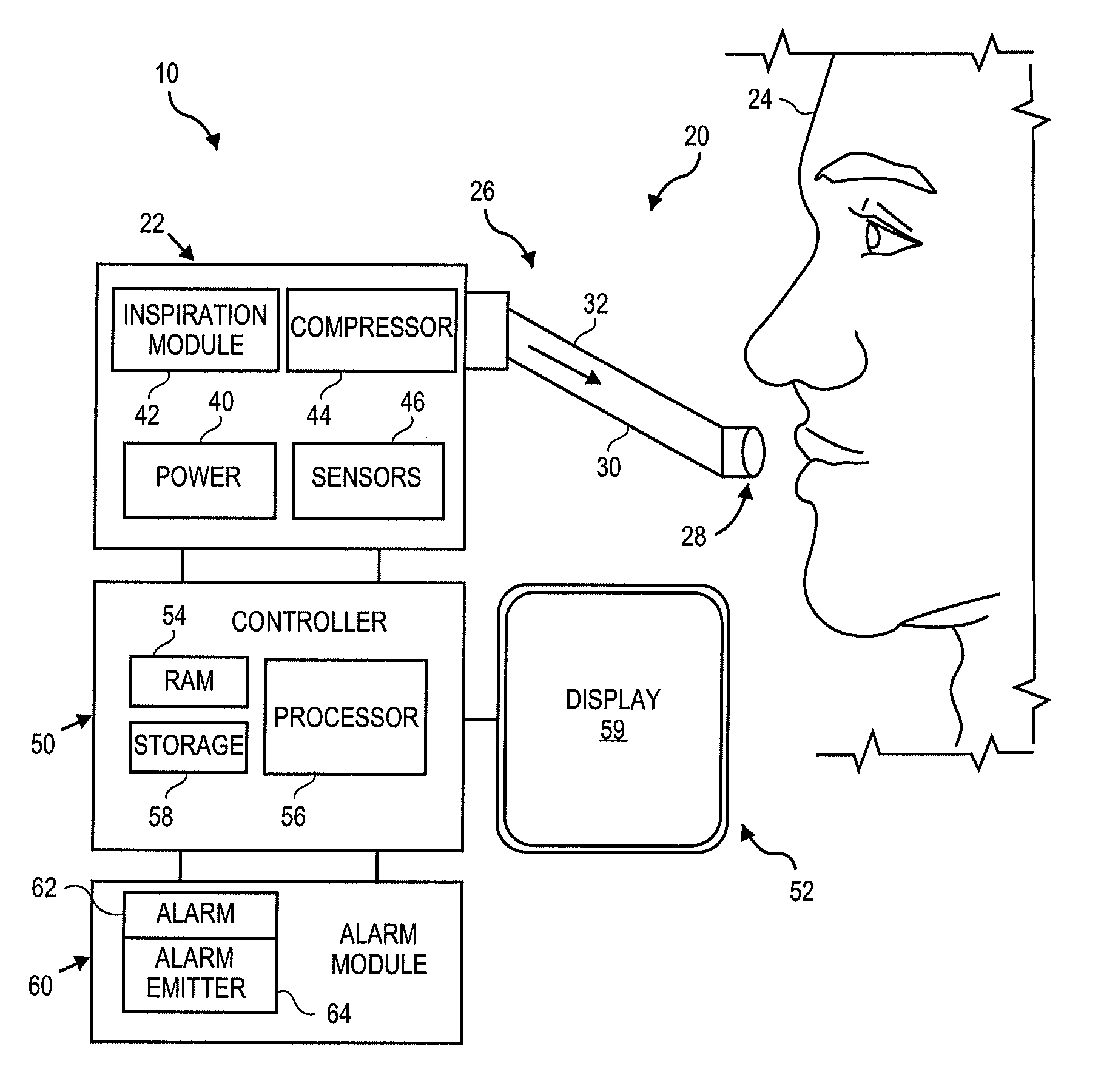 Systems and methods for providing ventilation based on patient need