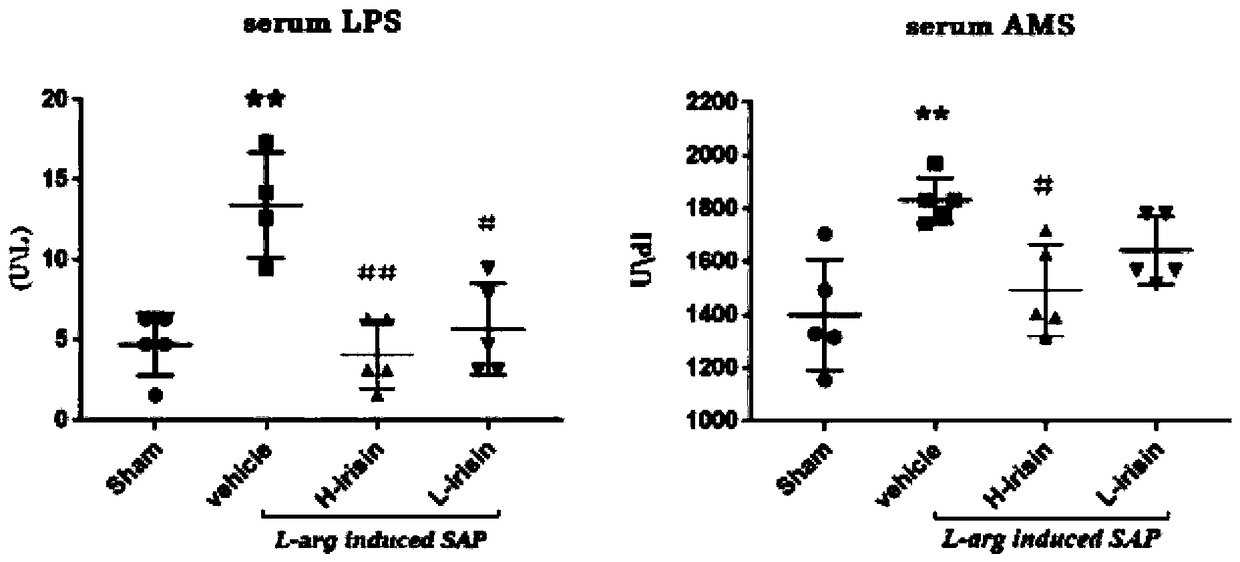 Application of irisin in drug for preventing and treating severe acute pancreatitis