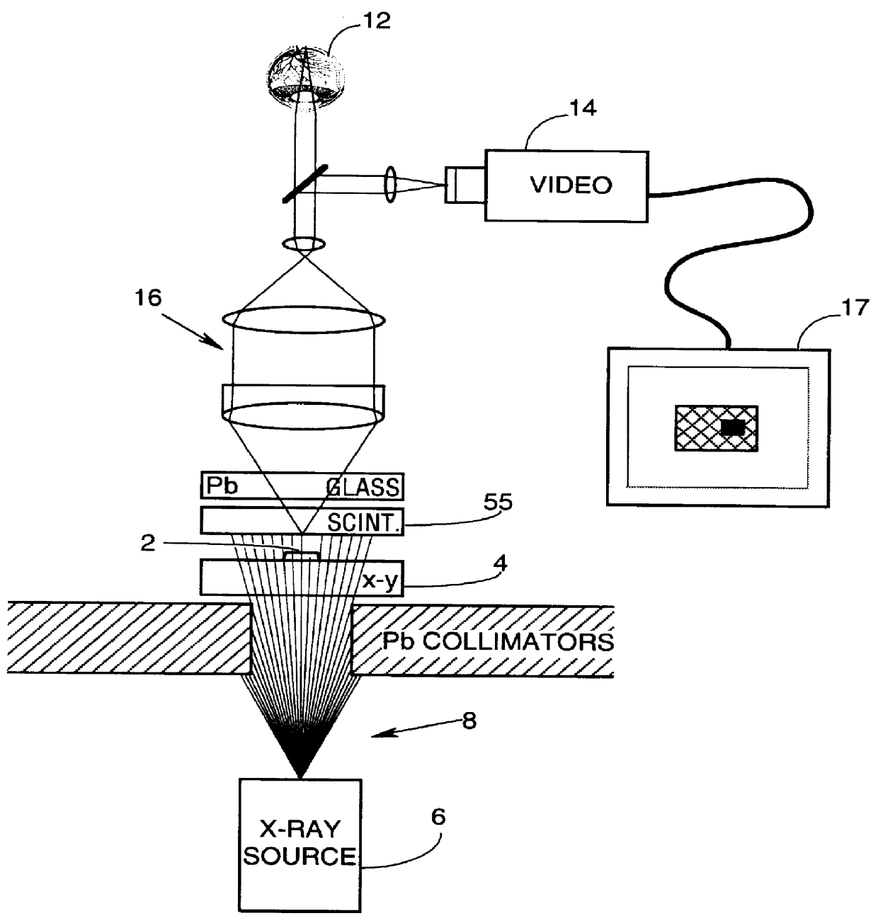 Scintillator based microscope