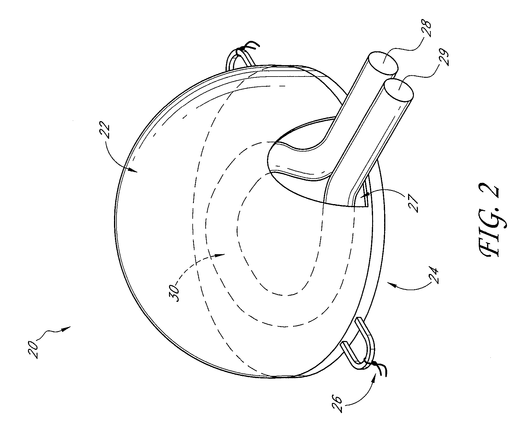 Vascularized tissue graft