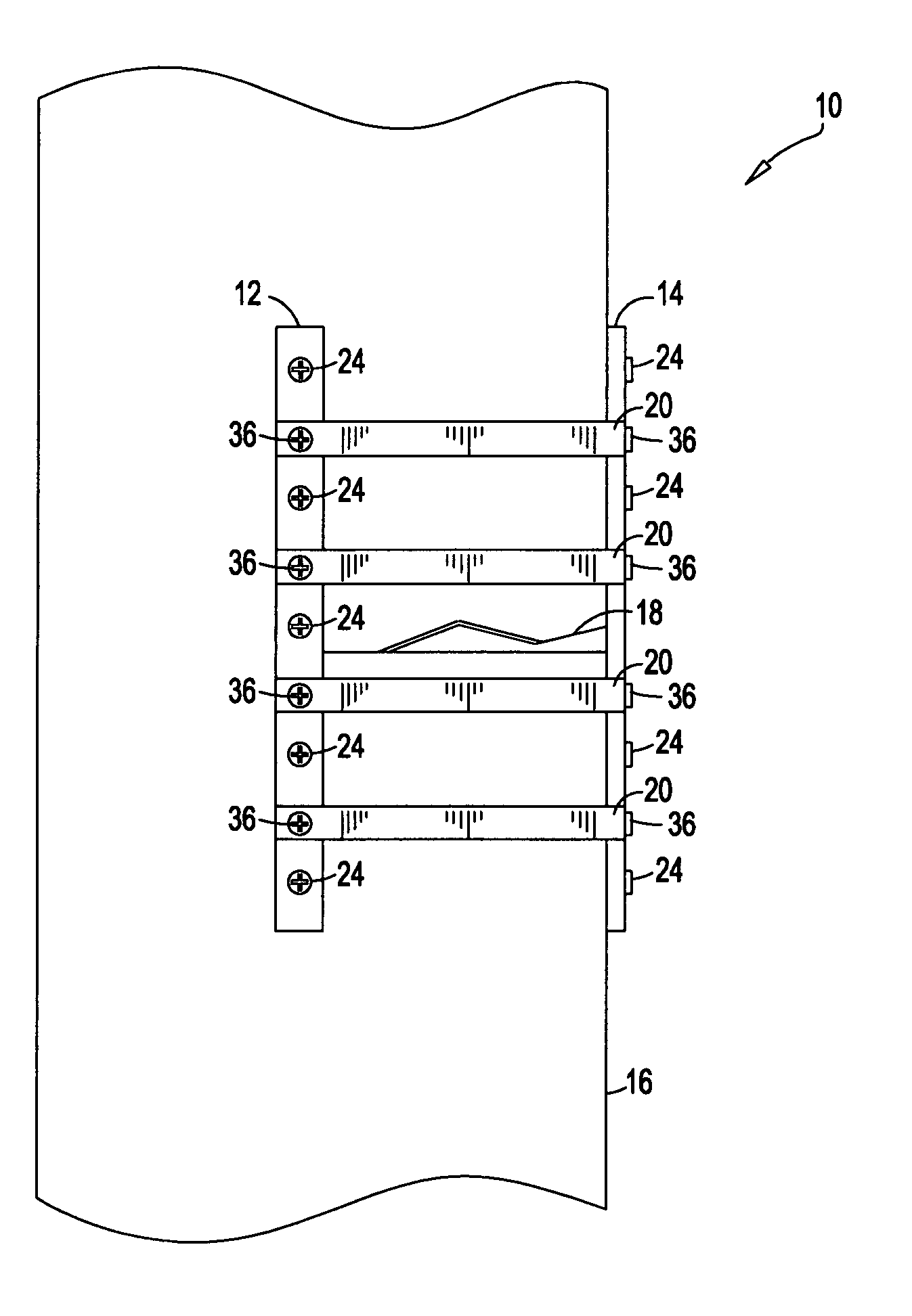 Method and device for treatment of orthopedic fractures