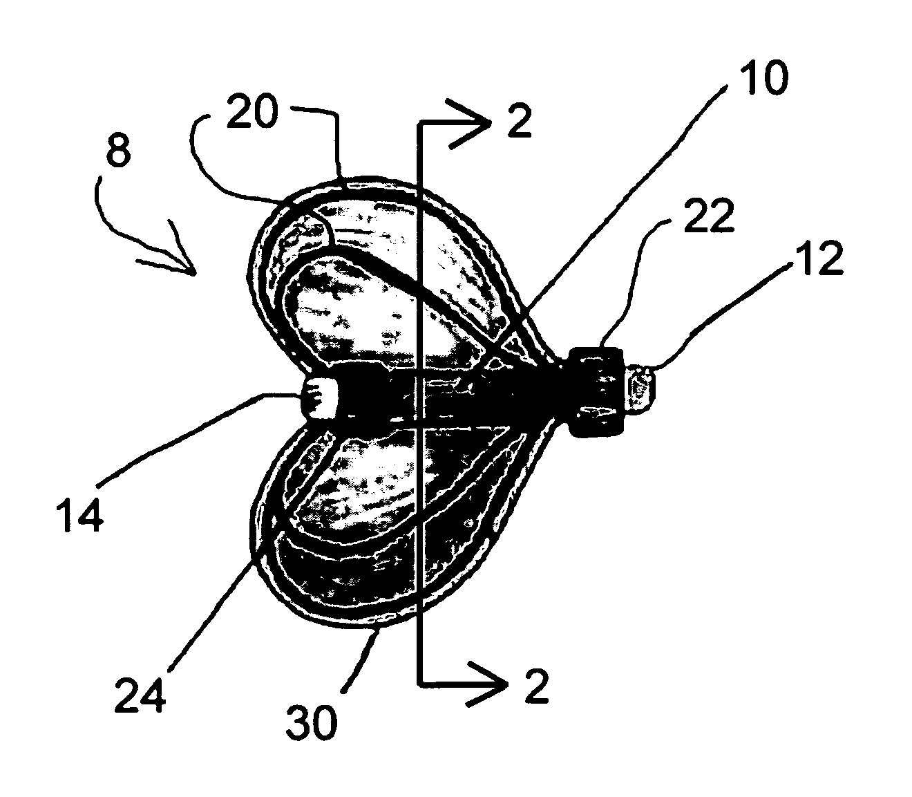 Balloon-expandable hearing device fitting system and self-expanding hearing device