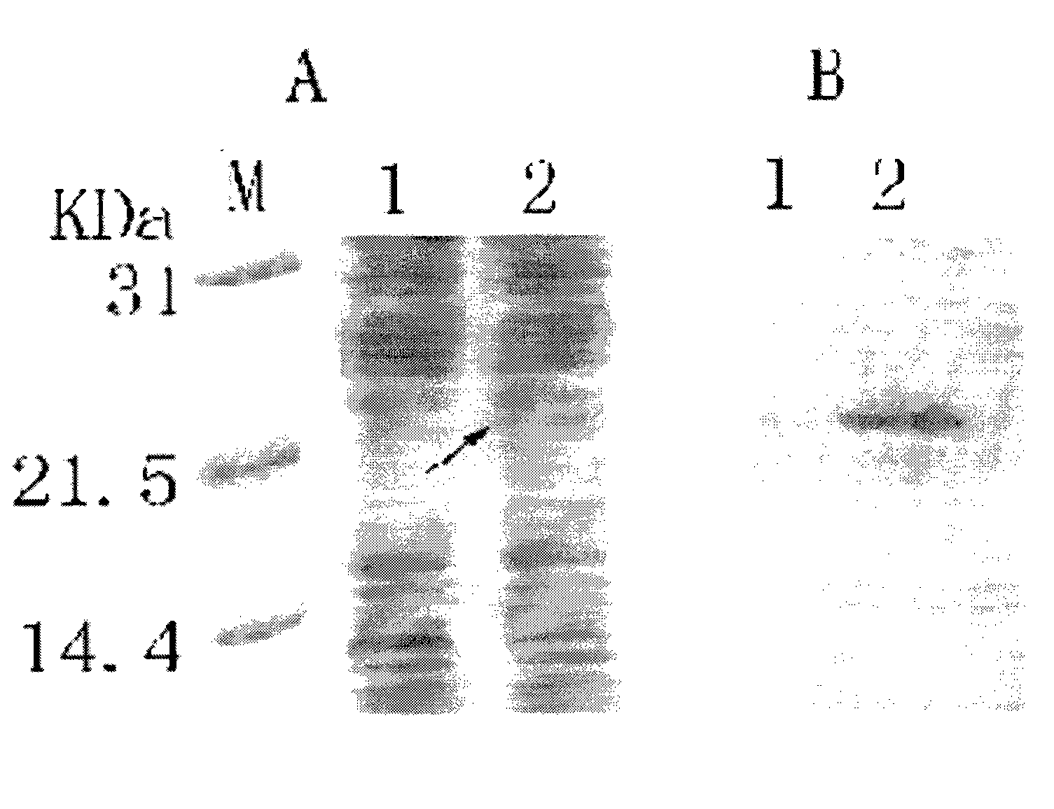 Recombined human growth hormone gene bacilliform virus, preparation and application thereof