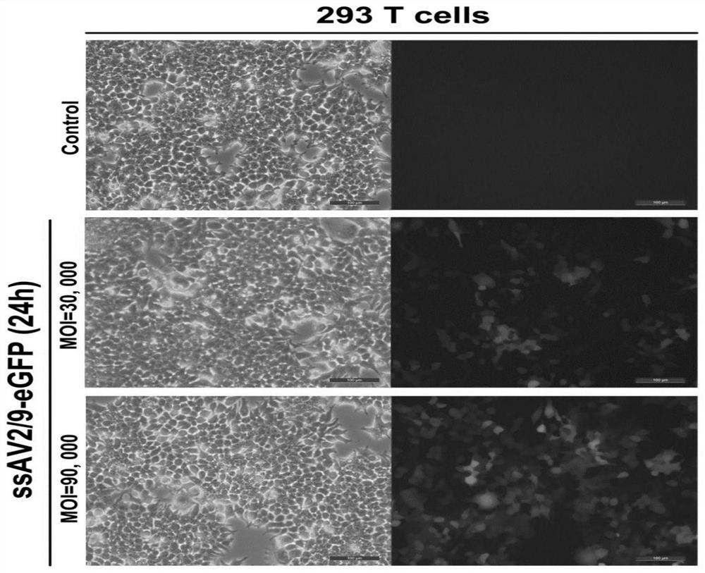 Adeno-associated viral vector for treating III A or III B type mucopolysaccharidosis and application