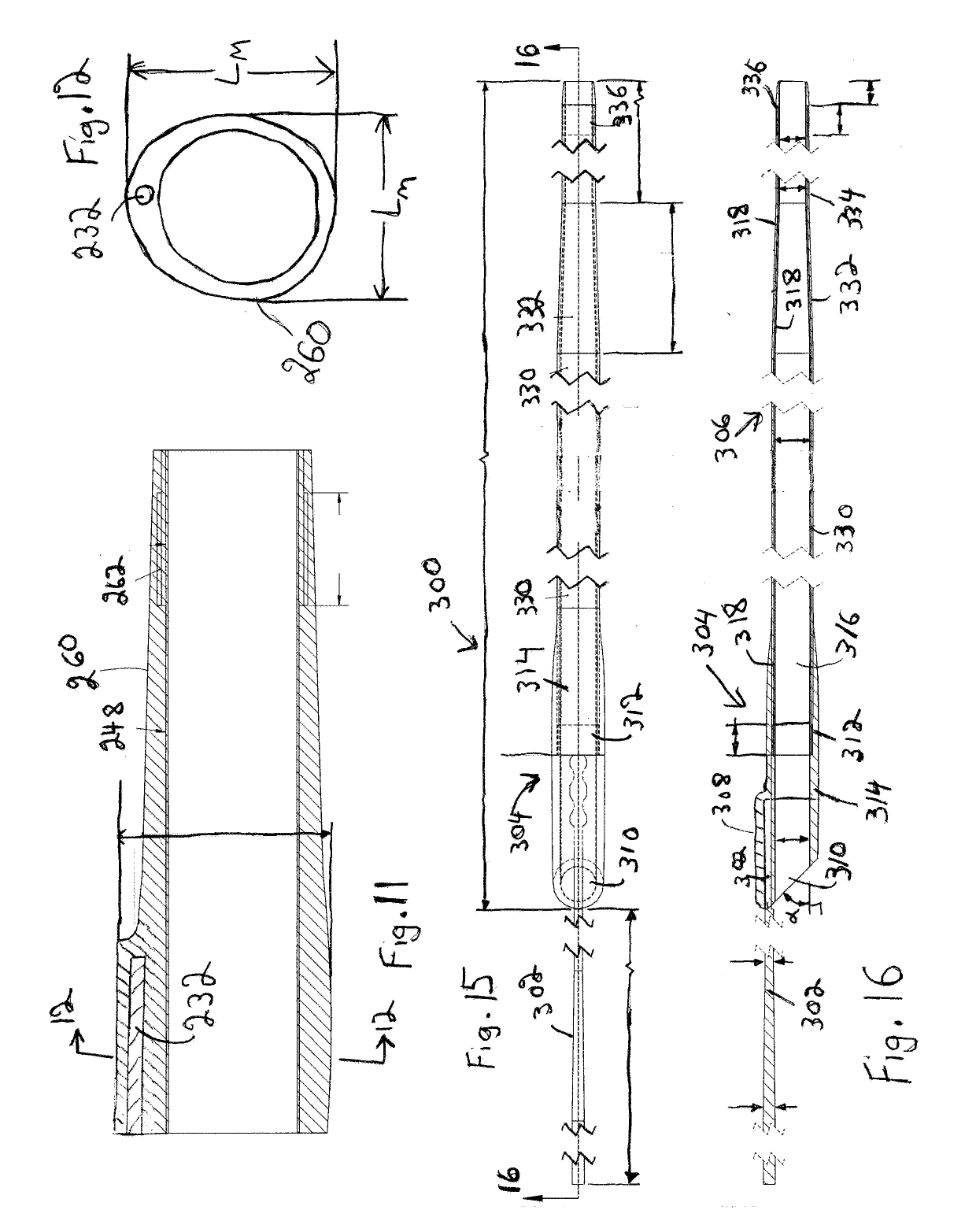 Suction catheter systems for applying effective aspiration in remote vessels, especially cerebral arteries