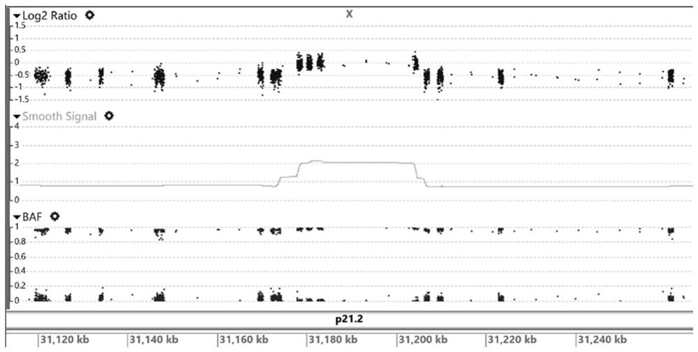 Kit and method for integrally and comprehensively detecting five complex genetic diseases