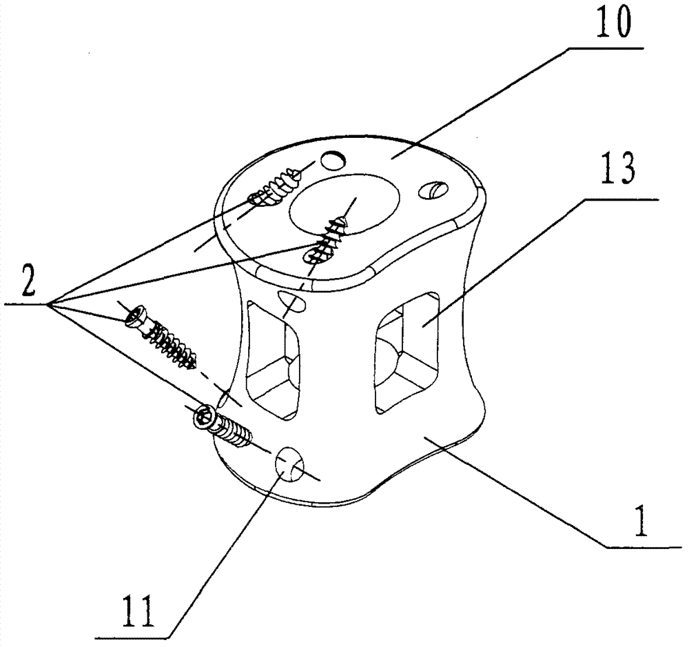 Self-stabilization artificial vertebral body