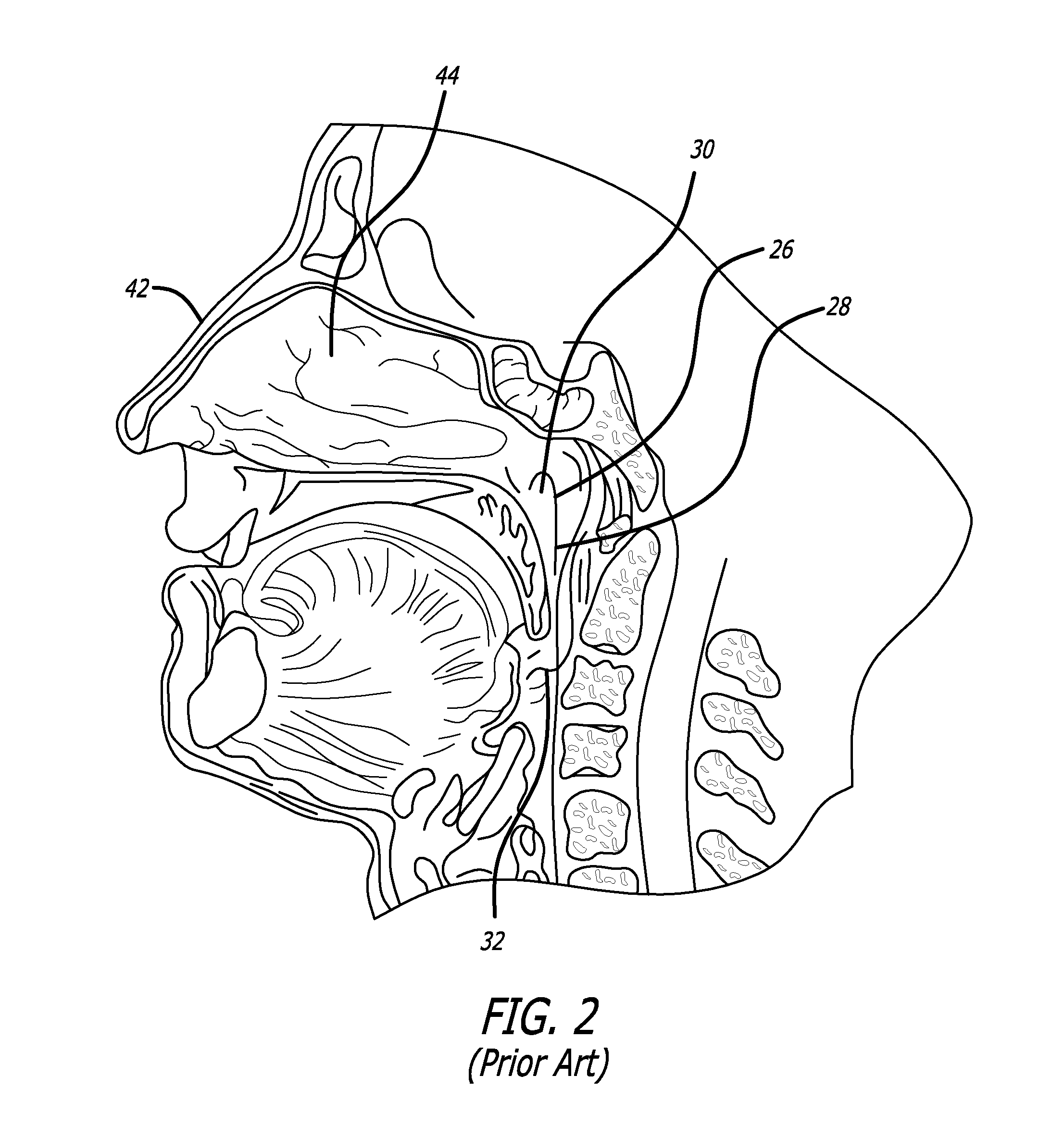 Method and System for Treating Target Tissue Within the Eustachian Tube