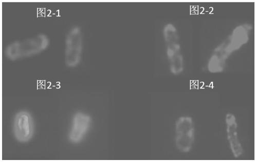 Recombinant Escherichia coli displaying pet decomposing enzyme on the cell surface and its construction and application