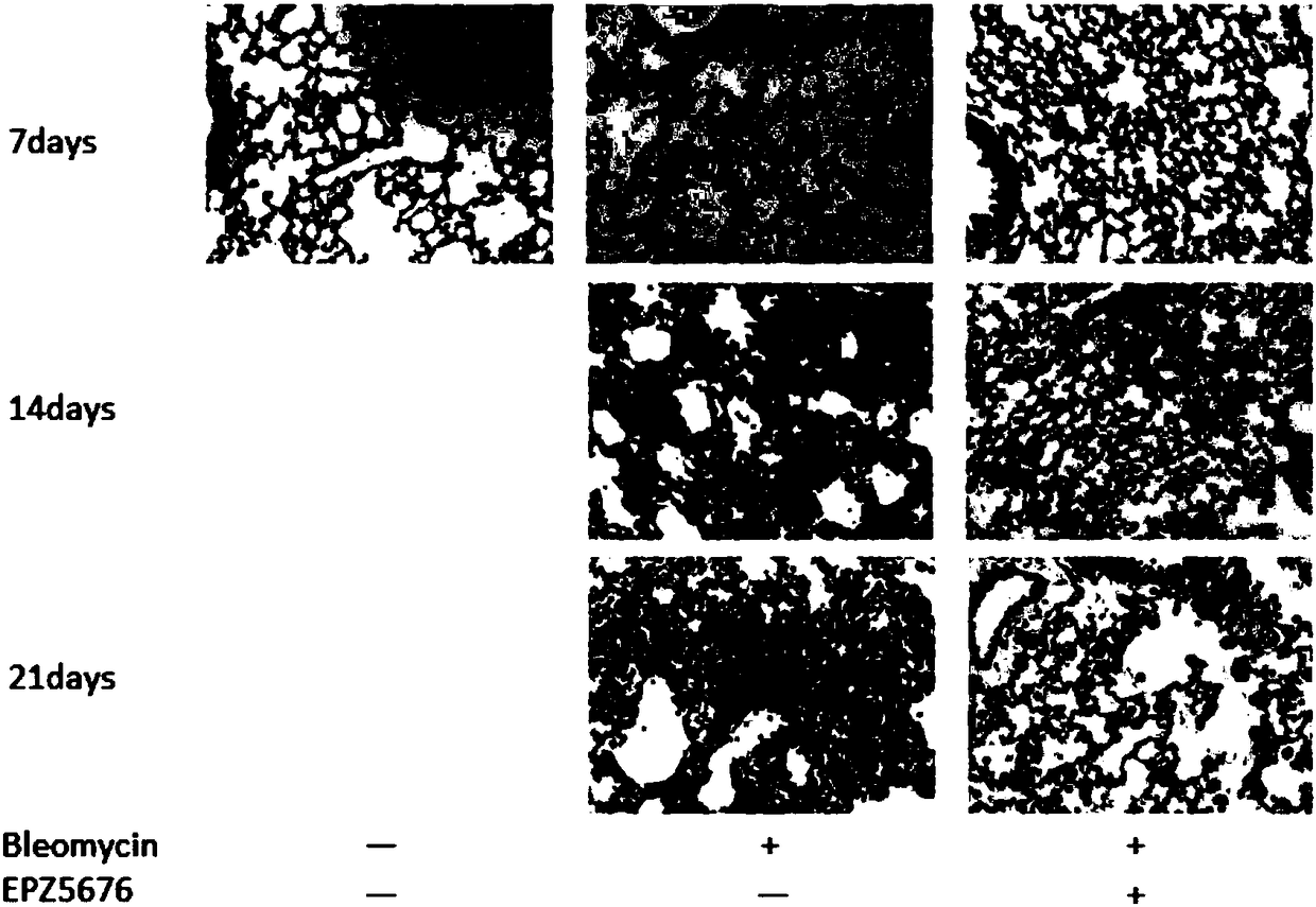 Application of compound EPZ5676 and related inhibitor thereof in preparing drug for preventing and treating pulmonary fibrosis diseases