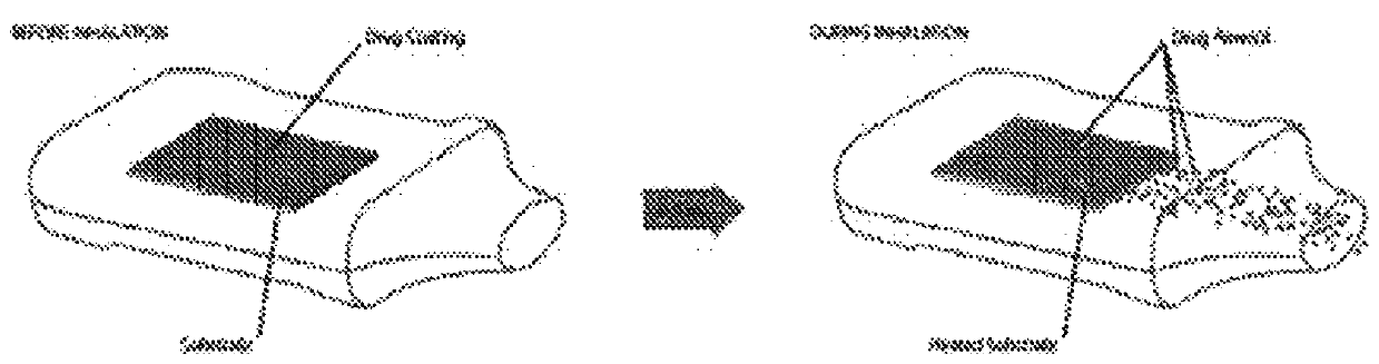 Method of treating epilepsy