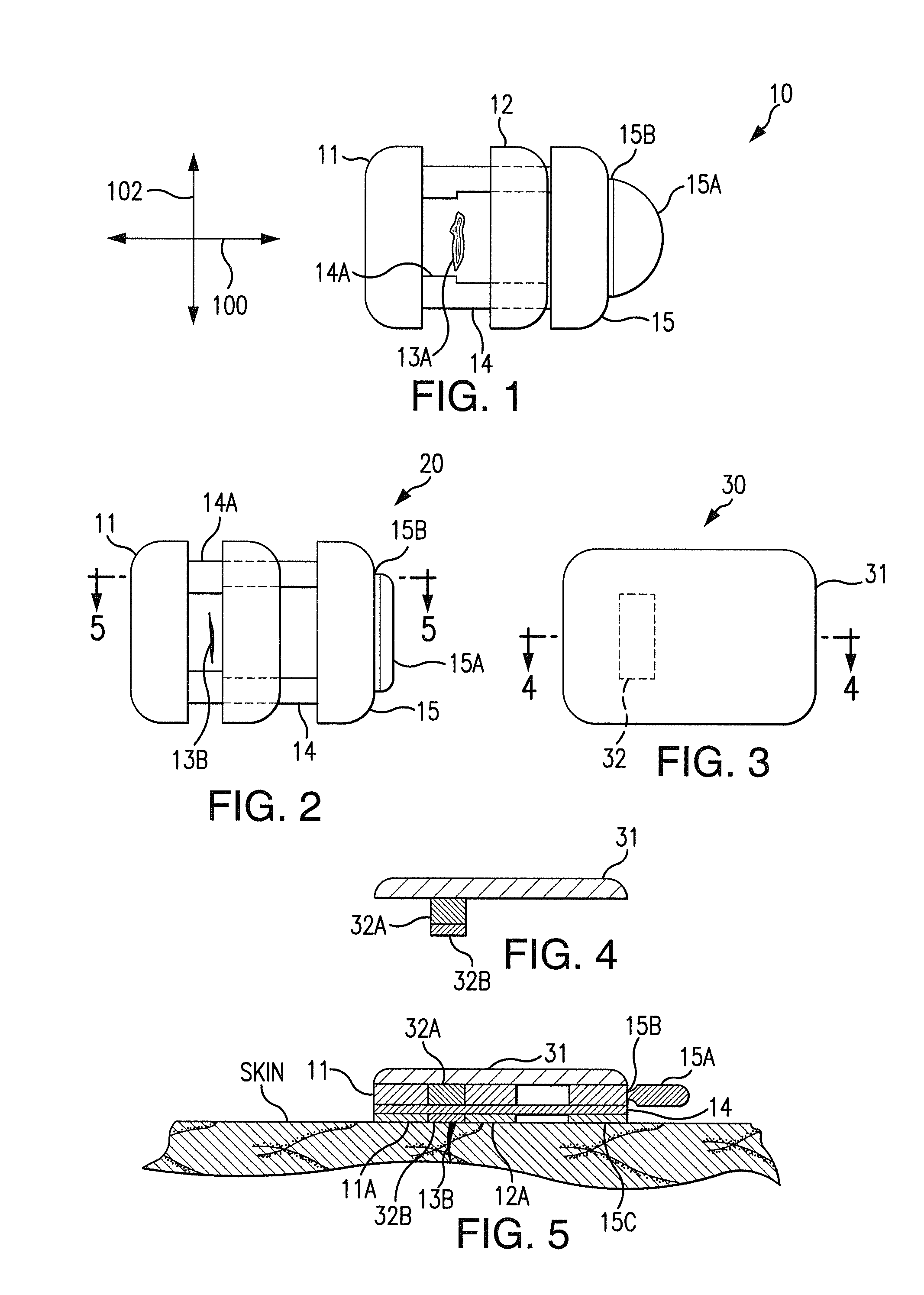 Device for the rapid closure of wounds and surgical incisions