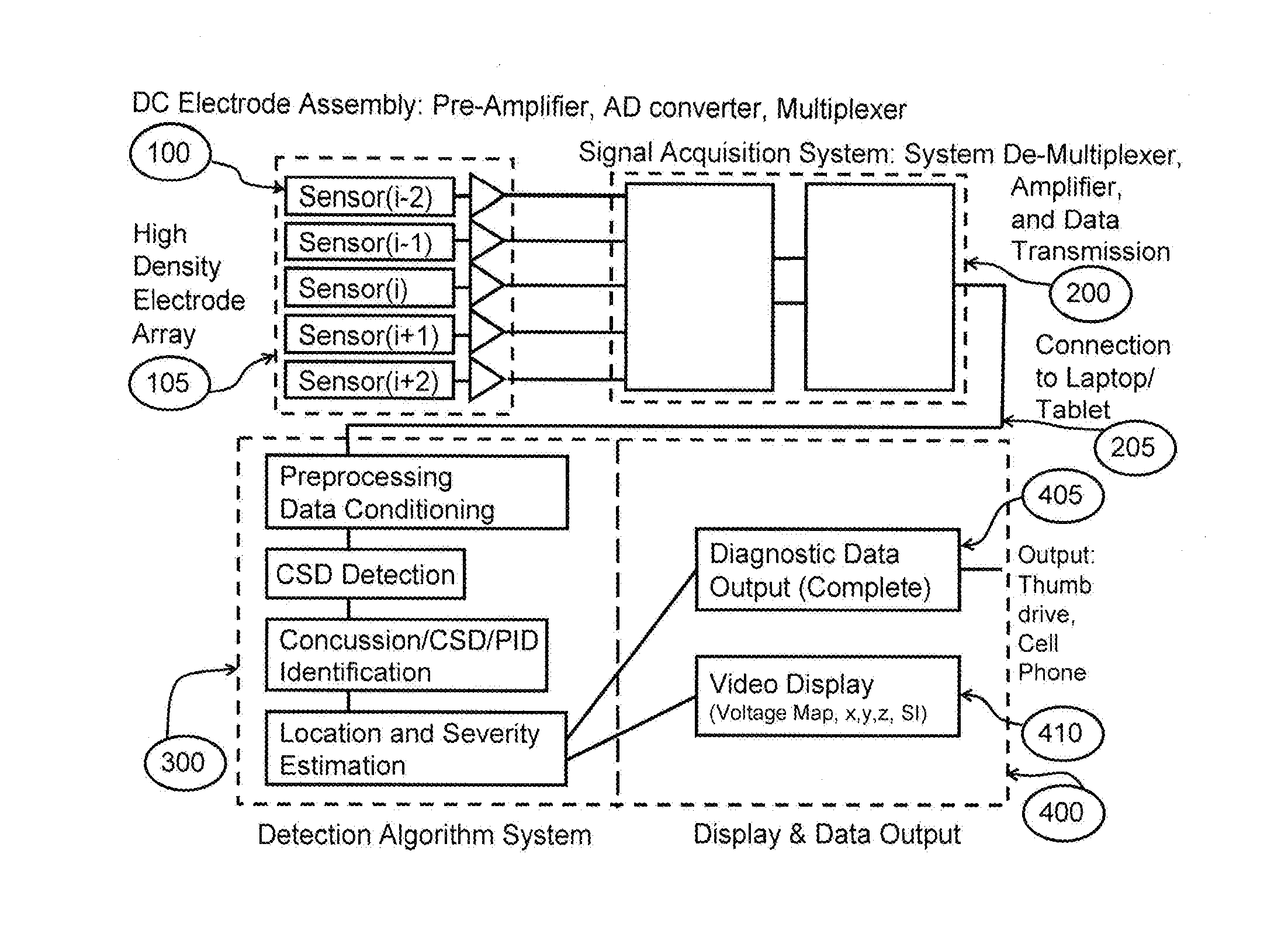 Non-Invasive Systems and Methods to Detect Cortical Spreading Depression for the Detection and Assessment of Brain Injury and Concussion