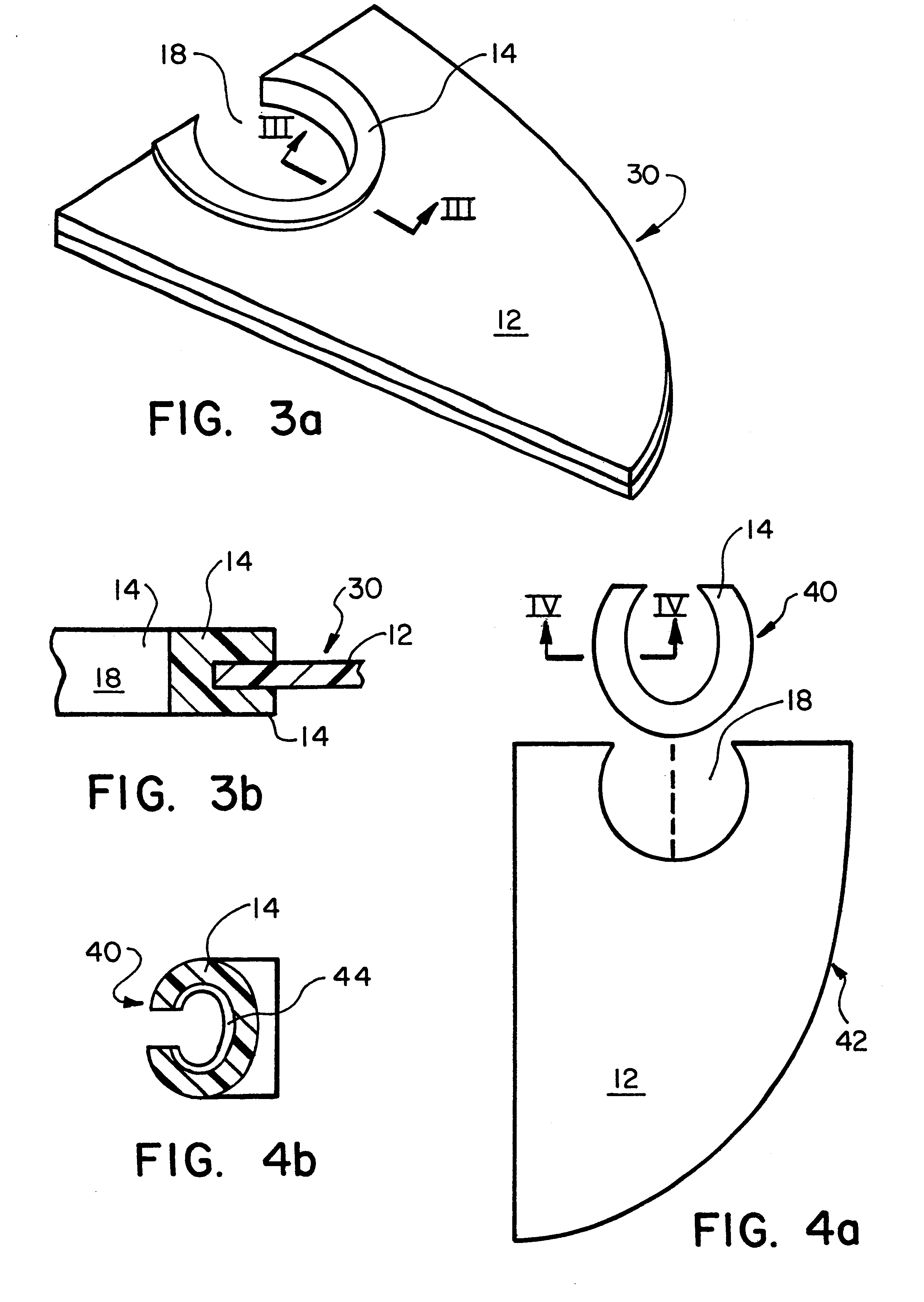 Hernia prosthesis