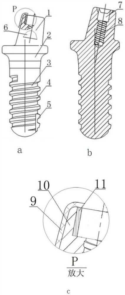 Whisker-reinforced zirconia implants