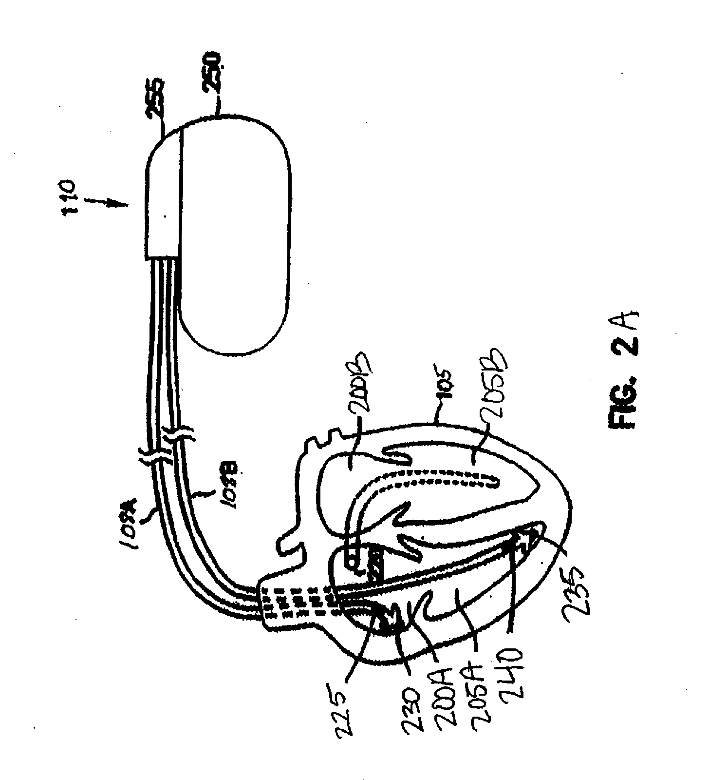 Baroreflex sensitivity monitoring and trending for tachyarrhythmia detection and therapy