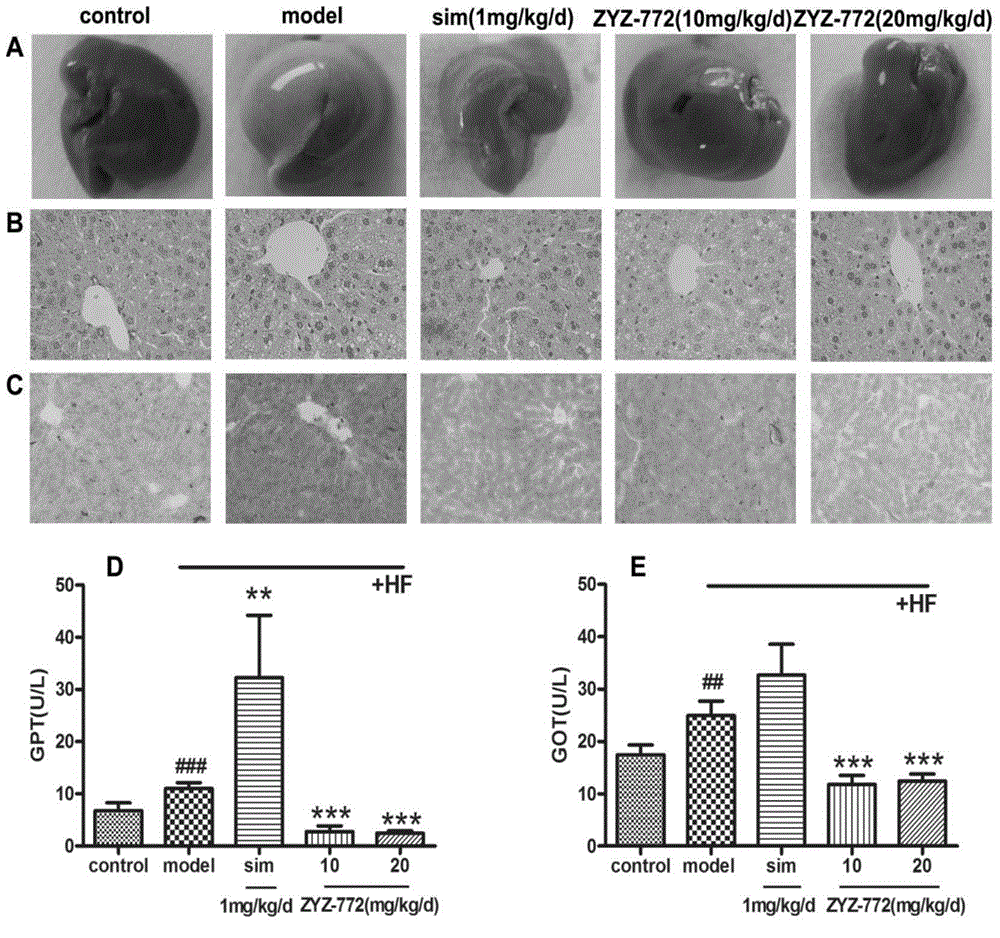 Pharmaceutical application of quercetin-3-O-(6''-O-alpha-L-rhamnose)-beta-D-glucose-O-beta-D-glucoside