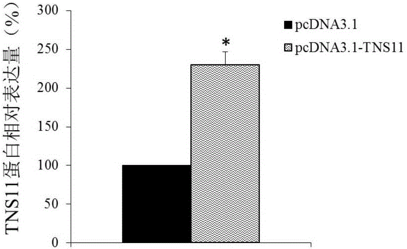 Application of TNS11 in preparing product for diagnosing and treating endometrial cancer