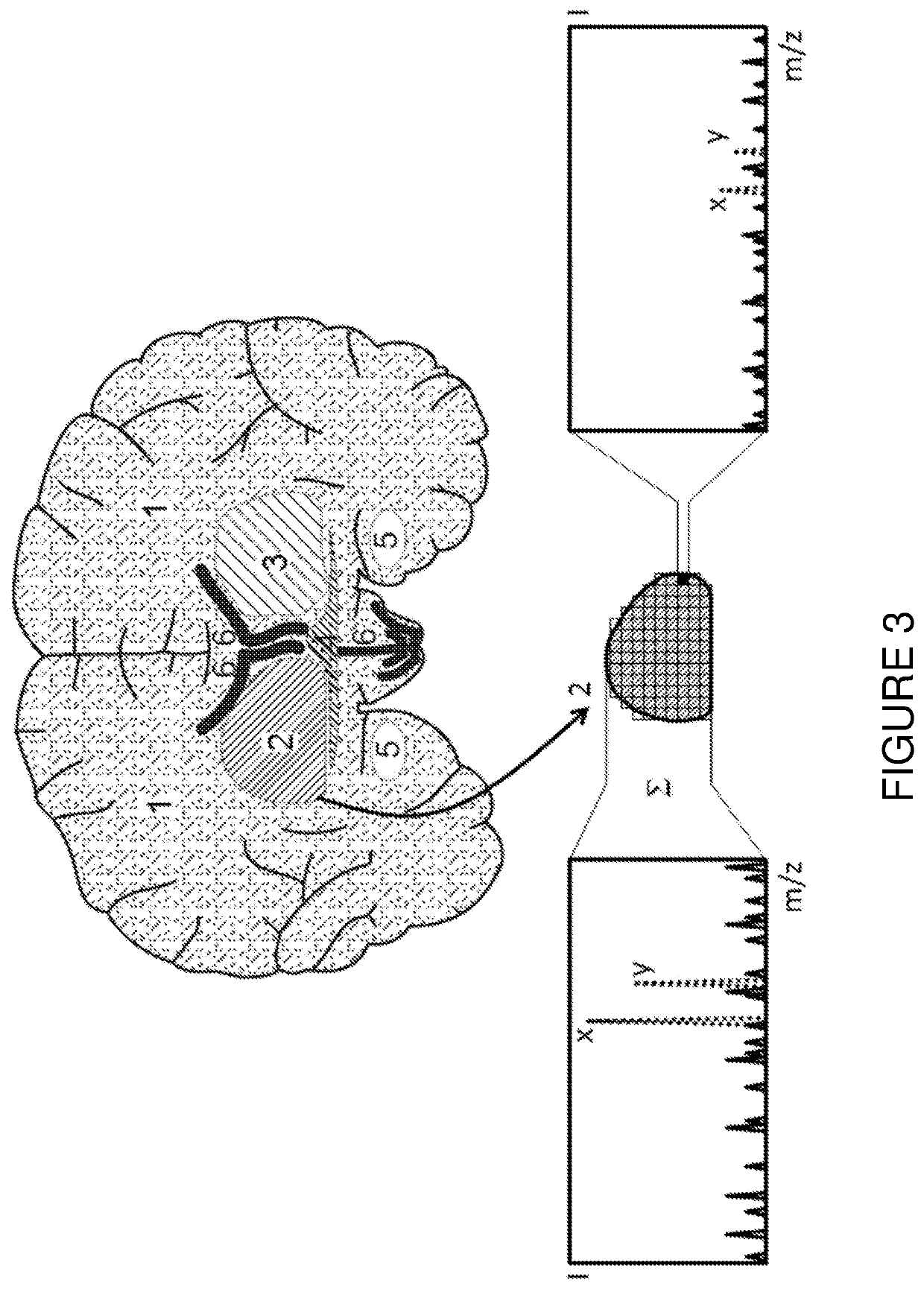 Mass spectrometric determination of particular tissue states