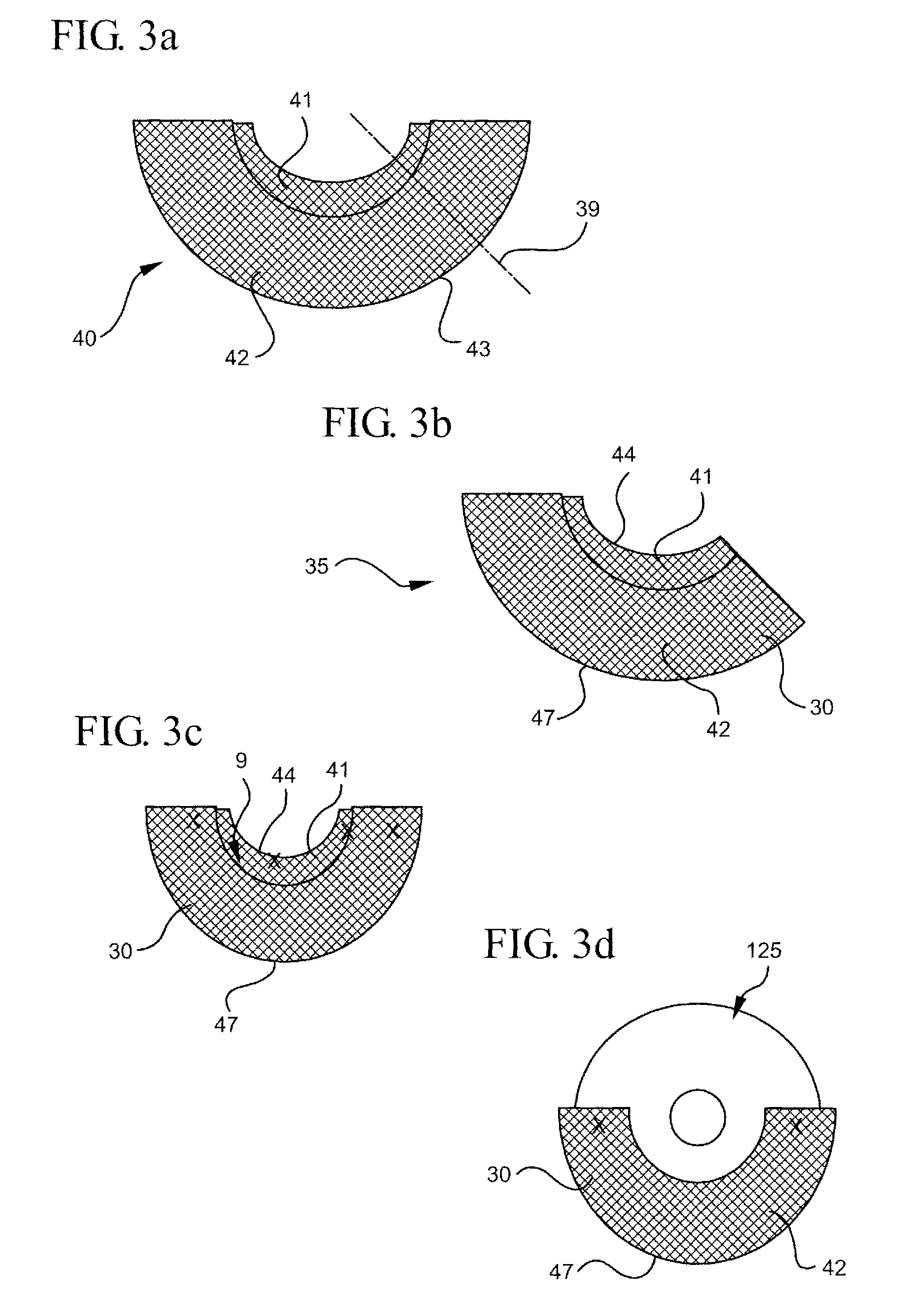 Naturally contoured, preformed, three dimensional mesh device for breast implant support