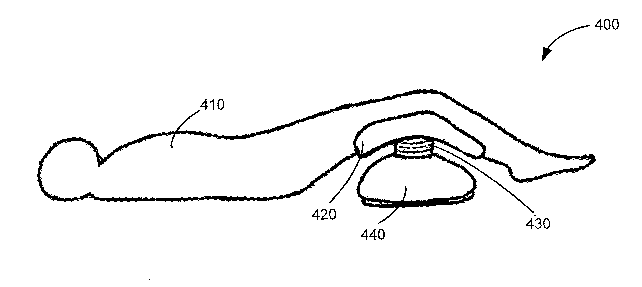 Methods and apparatuses for increasing mucociliary clearance