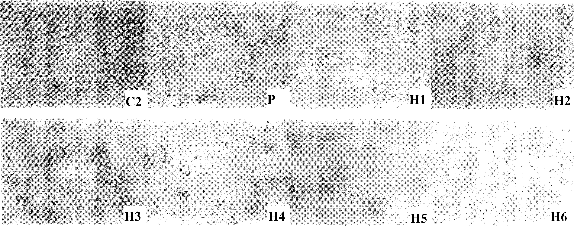 Recombinant Ganoderma lucidum immunoregulation protein with antineoplastic function and medicinal preparation thereof