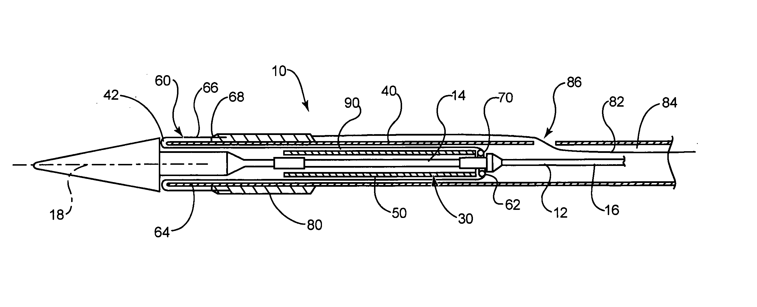 Stent delivery system