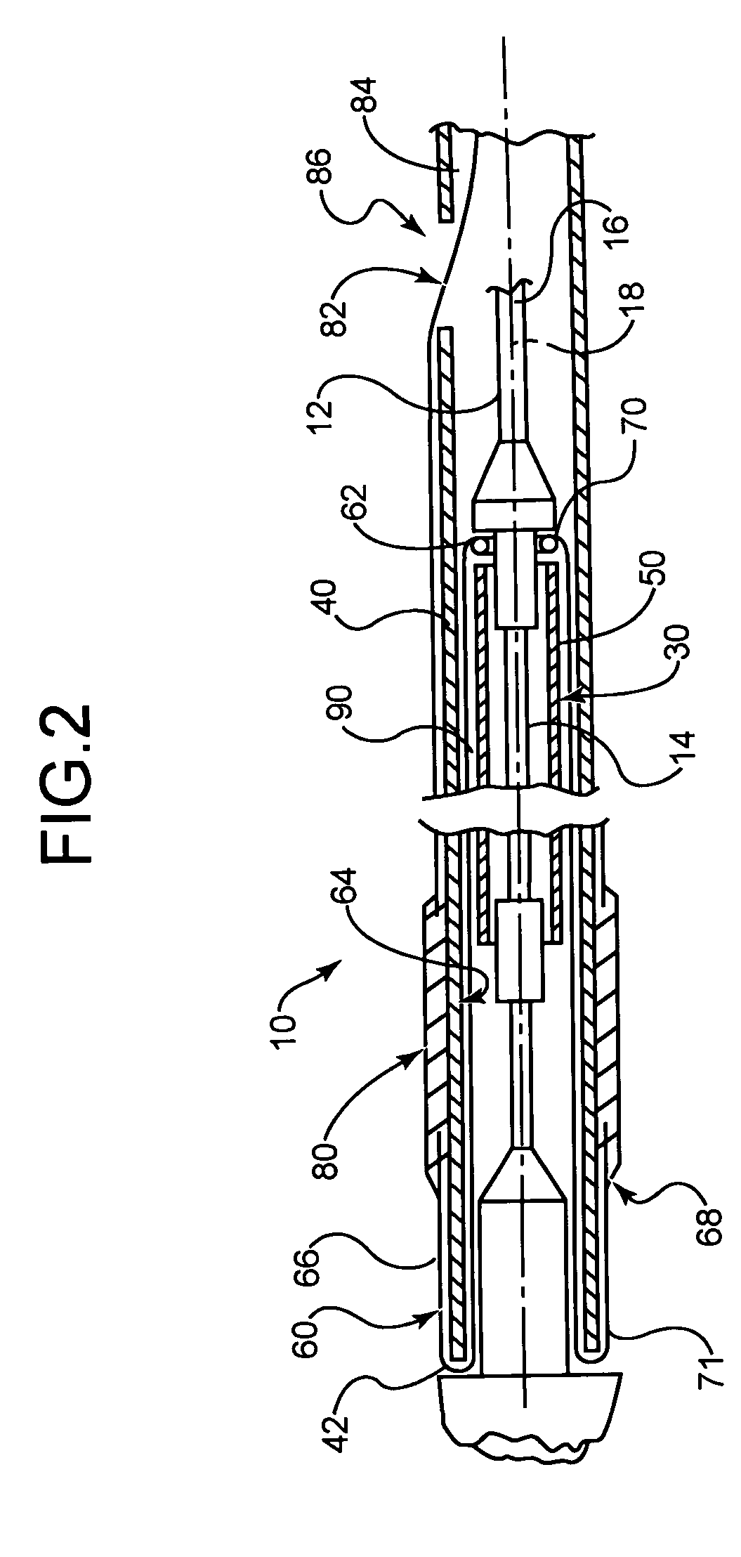 Stent delivery system