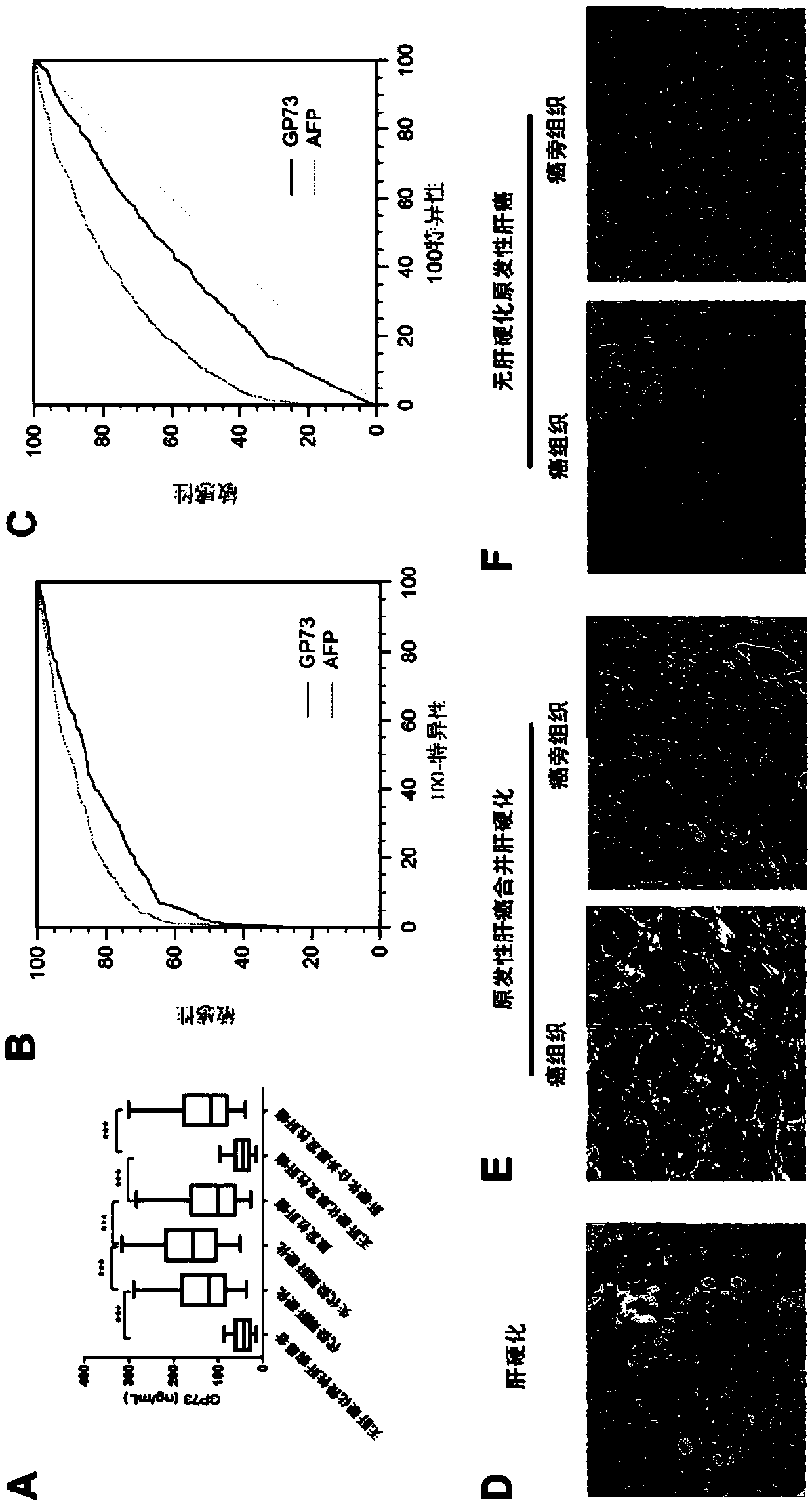 A new marker of cirrhosis or fibrosis