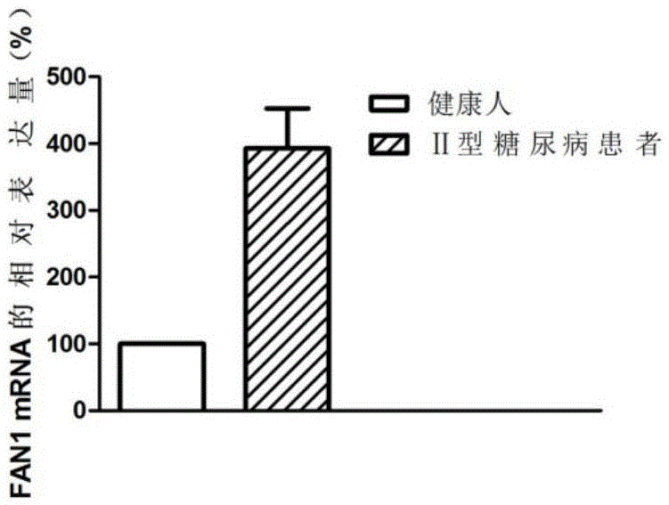 Application of FAN1 genes in II-type diabetes diagnosis