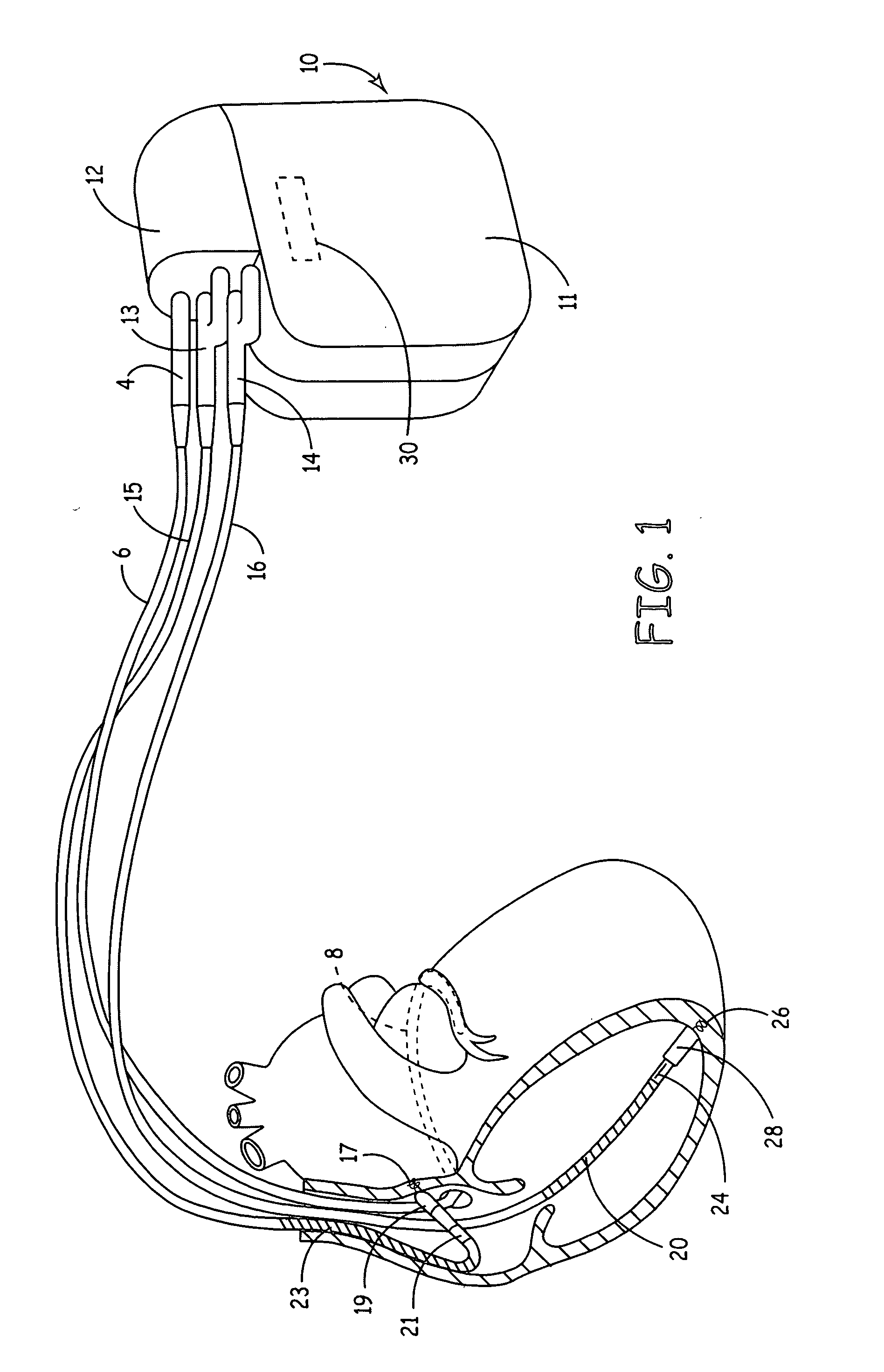 Method and apparatus for identifying lead-related conditions using prediction and detection criteria