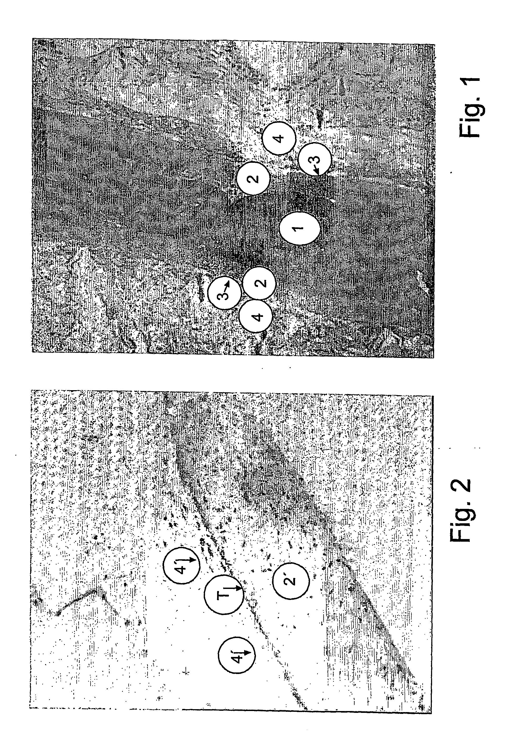 Bioartificial implant and its use and method of reducing the risk for formation of connective tissue after implantation