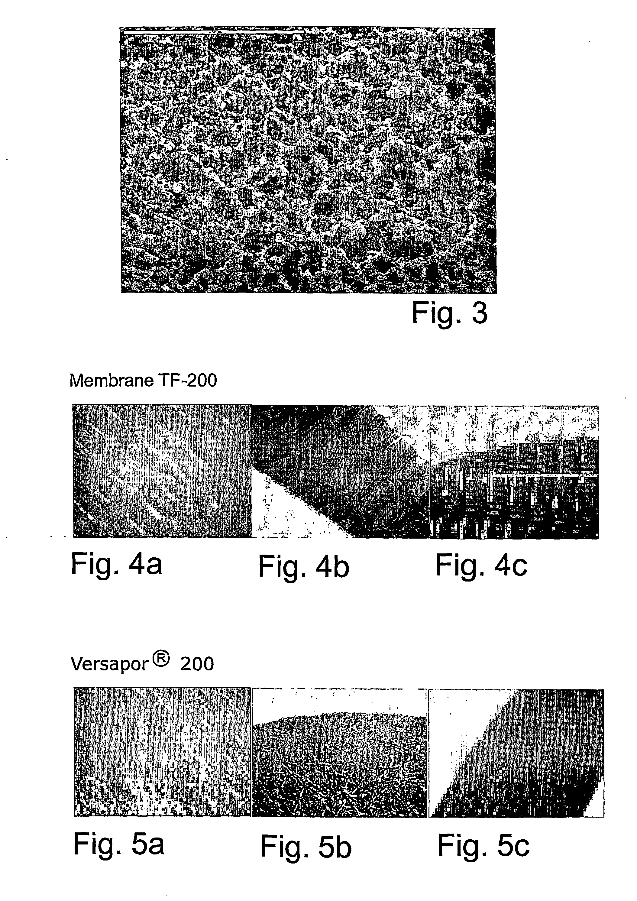 Bioartificial implant and its use and method of reducing the risk for formation of connective tissue after implantation