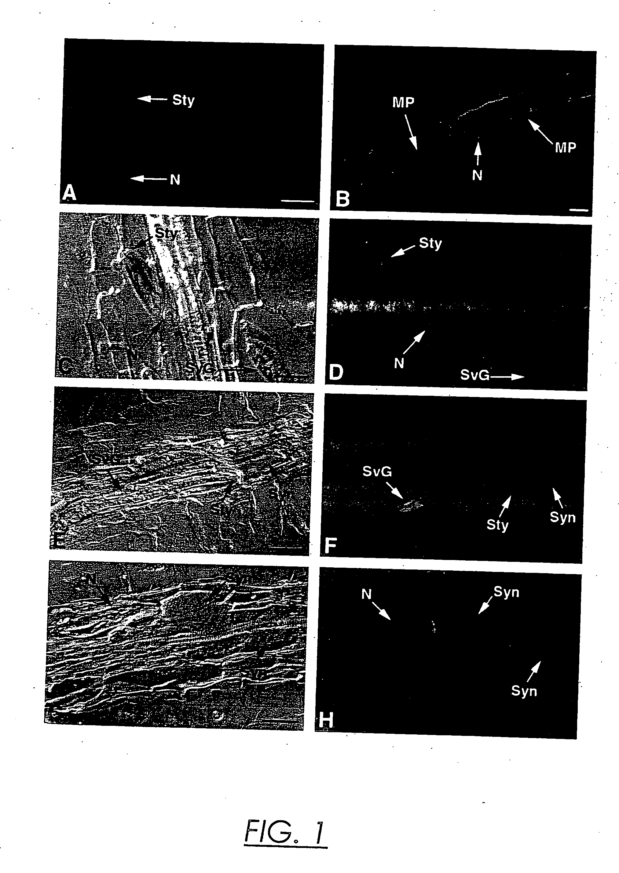 Endoglucanase gene promoter upregulated by nematodes