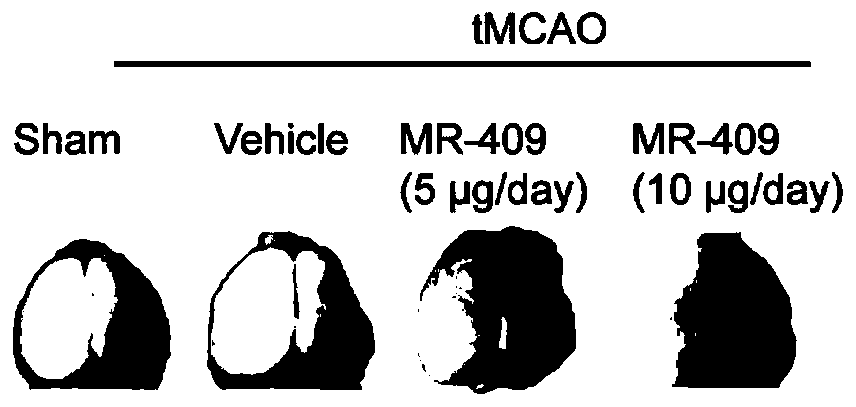 Application of GHRH-A in preparation of drugs for preventing and treating ischemic brain infarction