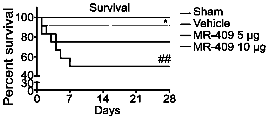 Application of GHRH-A in preparation of drugs for preventing and treating ischemic brain infarction