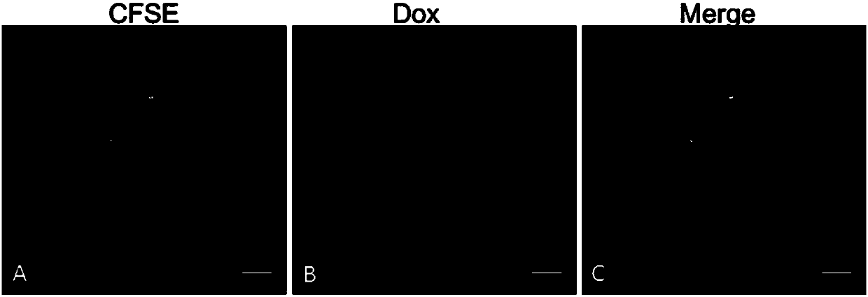 Tumor drug-loaded microparticle preparation and preparation method thereof