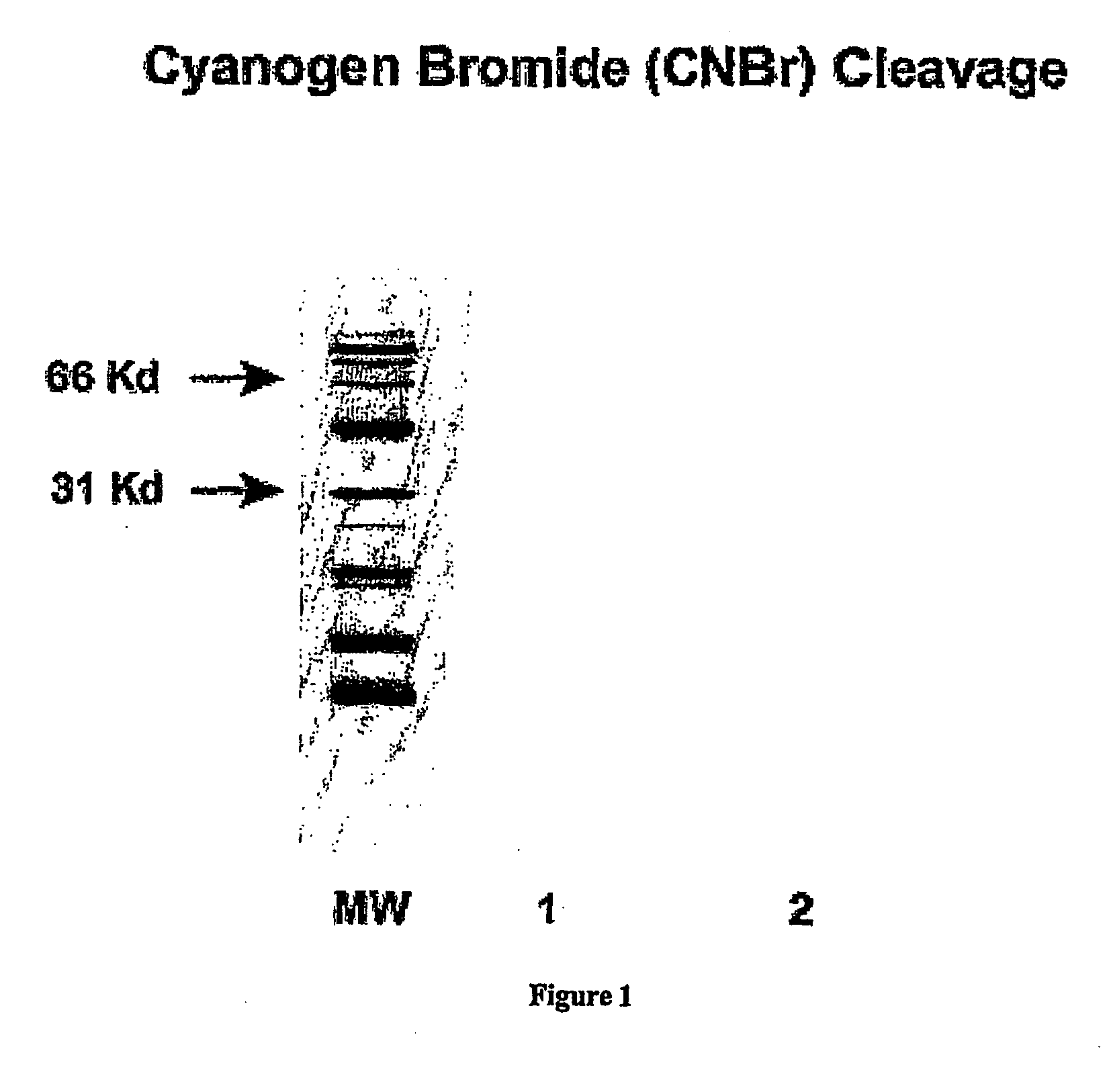 Repeat sequences of the ca125 gene and their use for diagnostic and therapeutic interventions