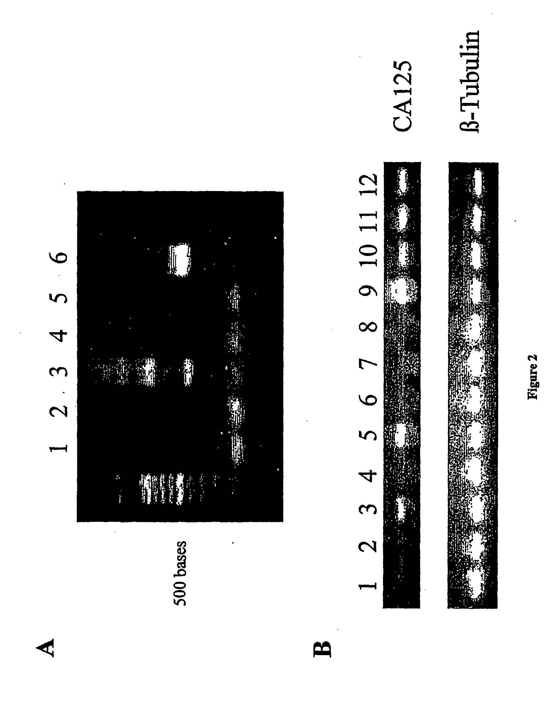 Repeat sequences of the ca125 gene and their use for diagnostic and therapeutic interventions