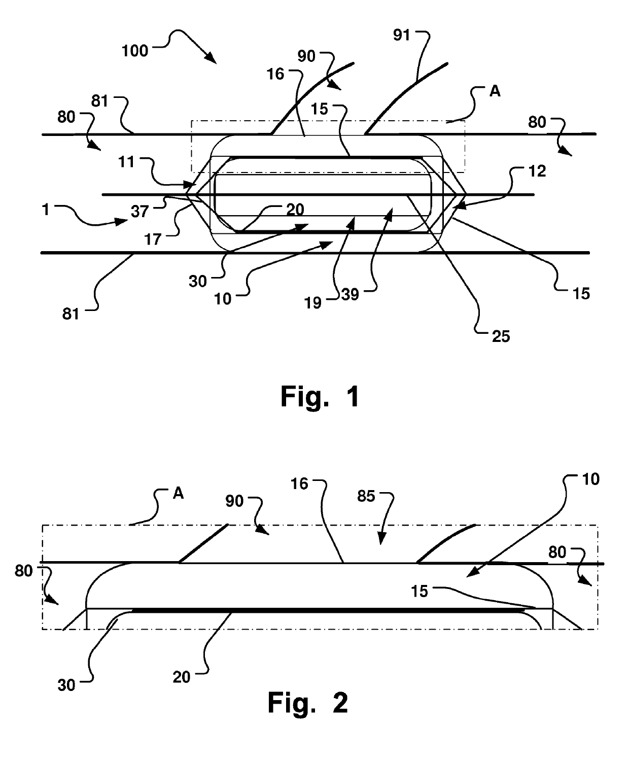 Medical Device, Method And System For Temporary Occlusion Of An Opening In A Lumen Of A Body