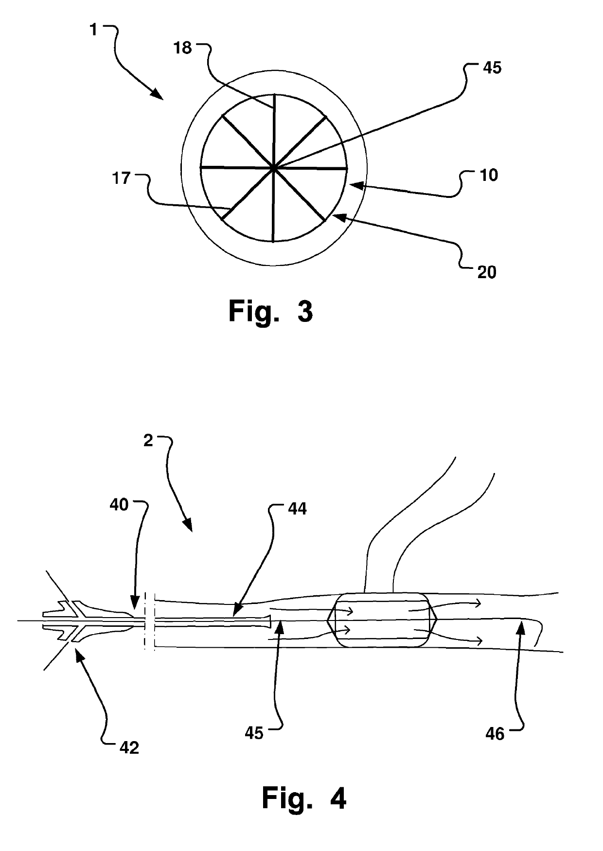 Medical Device, Method And System For Temporary Occlusion Of An Opening In A Lumen Of A Body