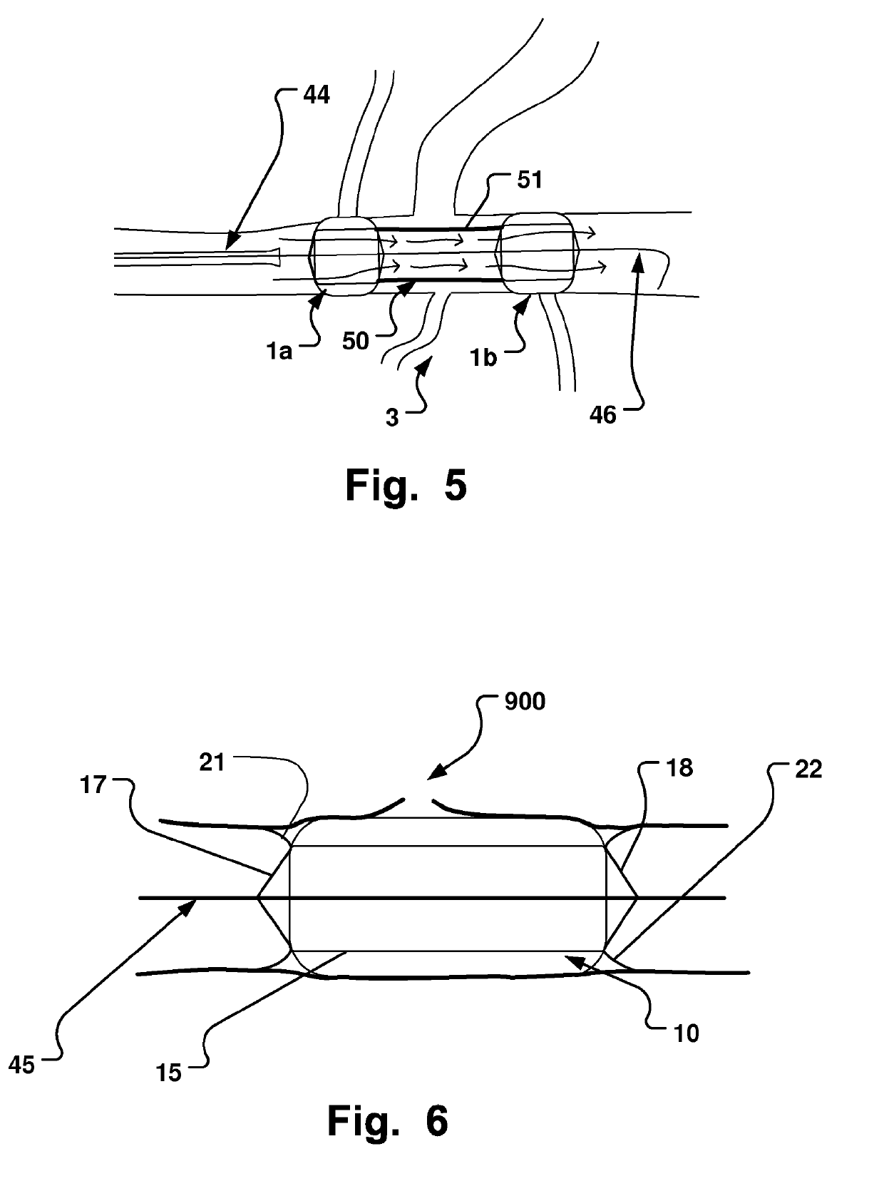 Medical Device, Method And System For Temporary Occlusion Of An Opening In A Lumen Of A Body